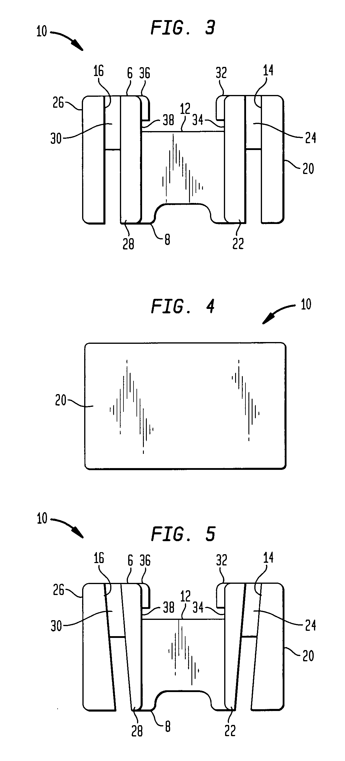 Navigated femoral neck resection guide and method