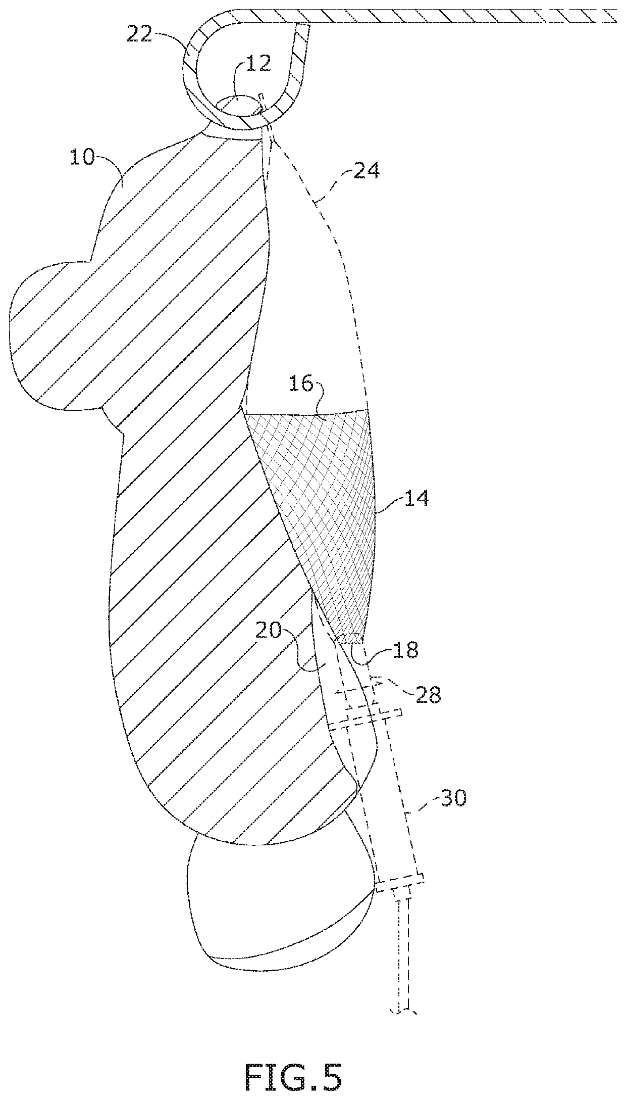 Therapeutic pouch for concealing intravenous therapy equipment