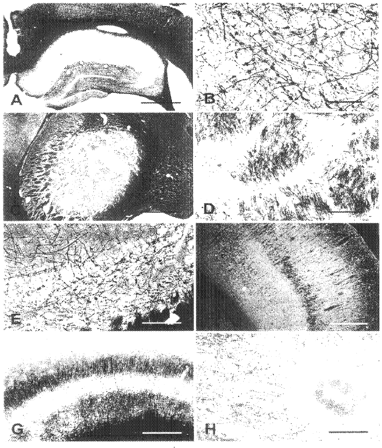 Histochemical labeling stain for myelin in brain tissue