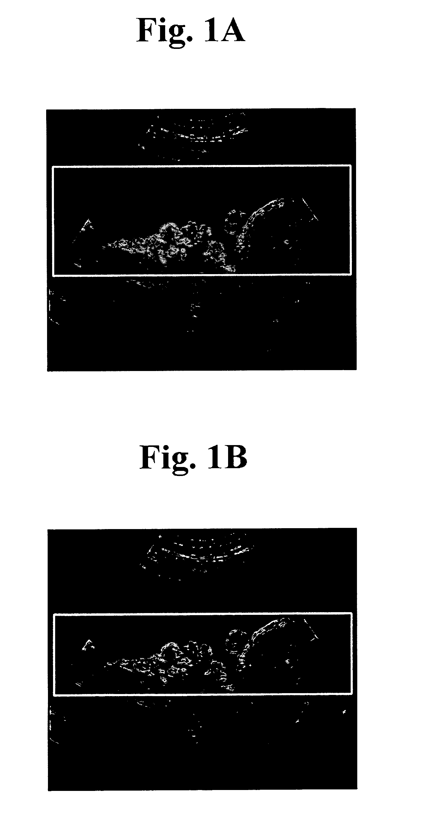 Apparatus and method for forming 3D ultrasound image