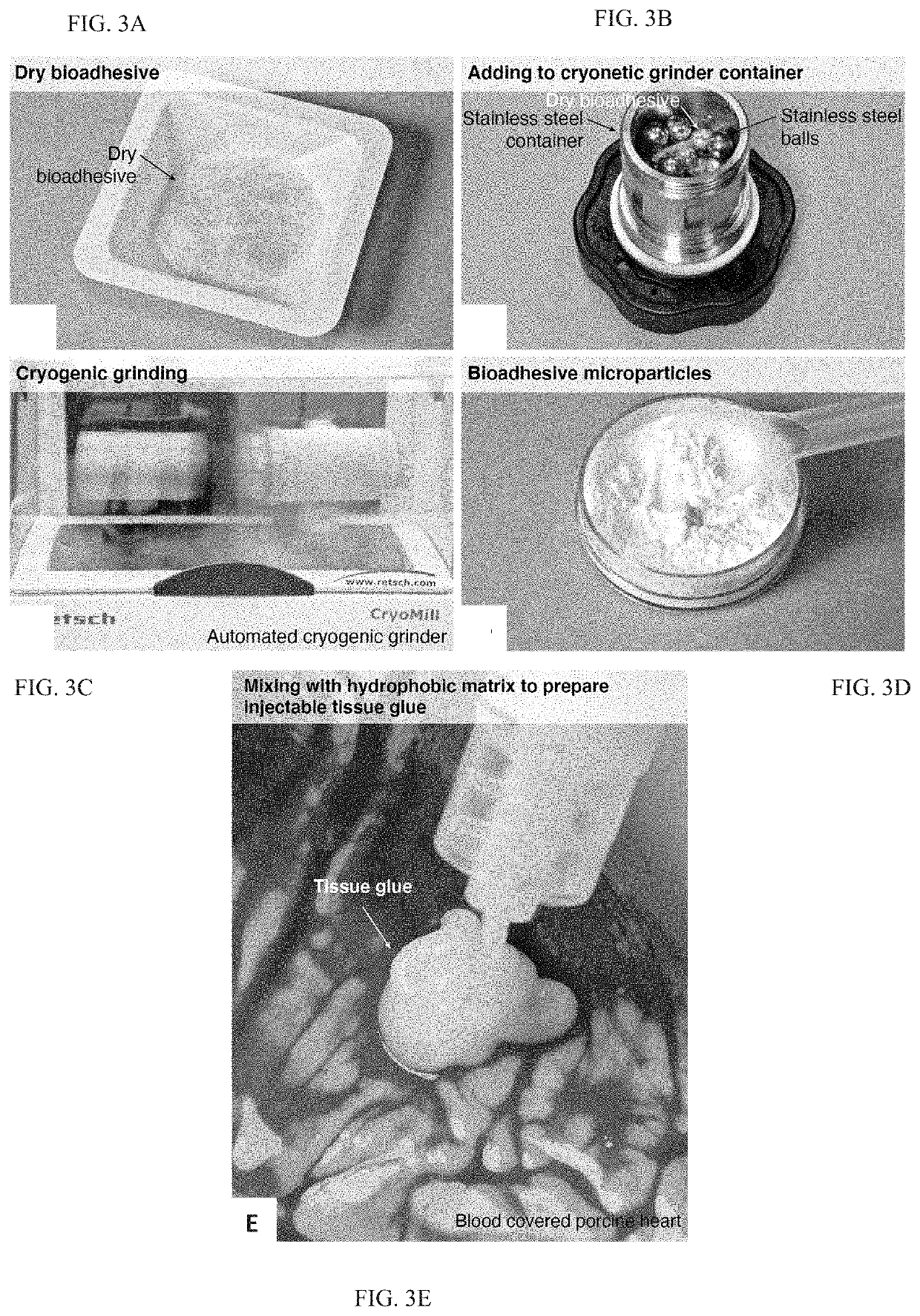 Body fluid resistant tissue adhesives