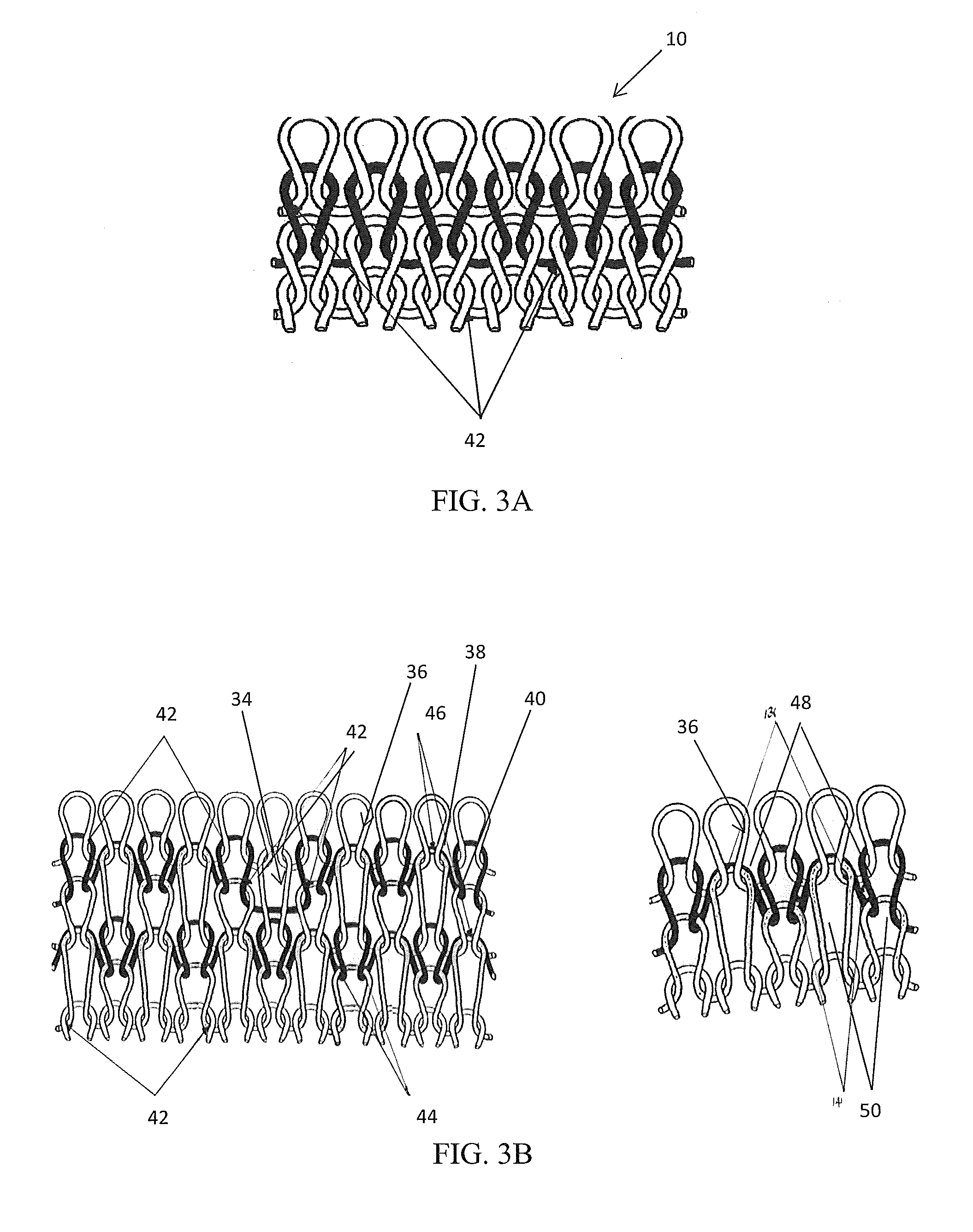 Method for making electrically conductive textiles and textile sensor