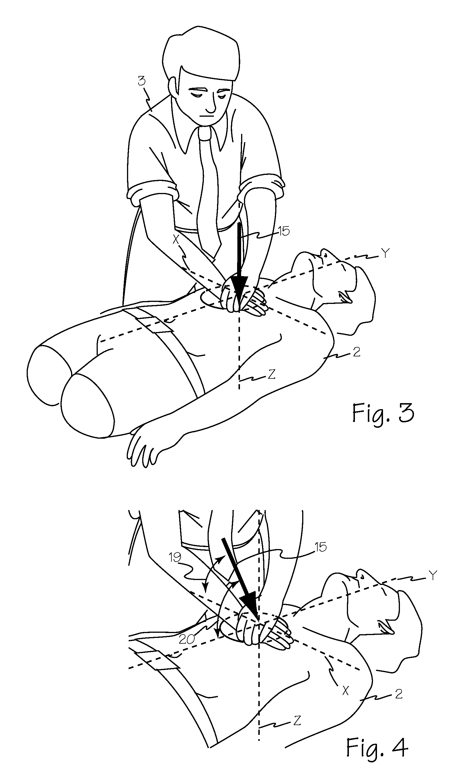 Method and apparatus for monitoring manual chest compression efficiency during CPR