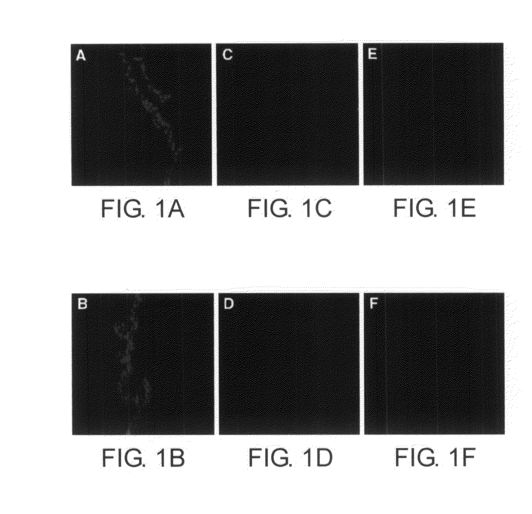 Method of treating the chemotoxic effects of chemotherapeutic drugs on brain tissue