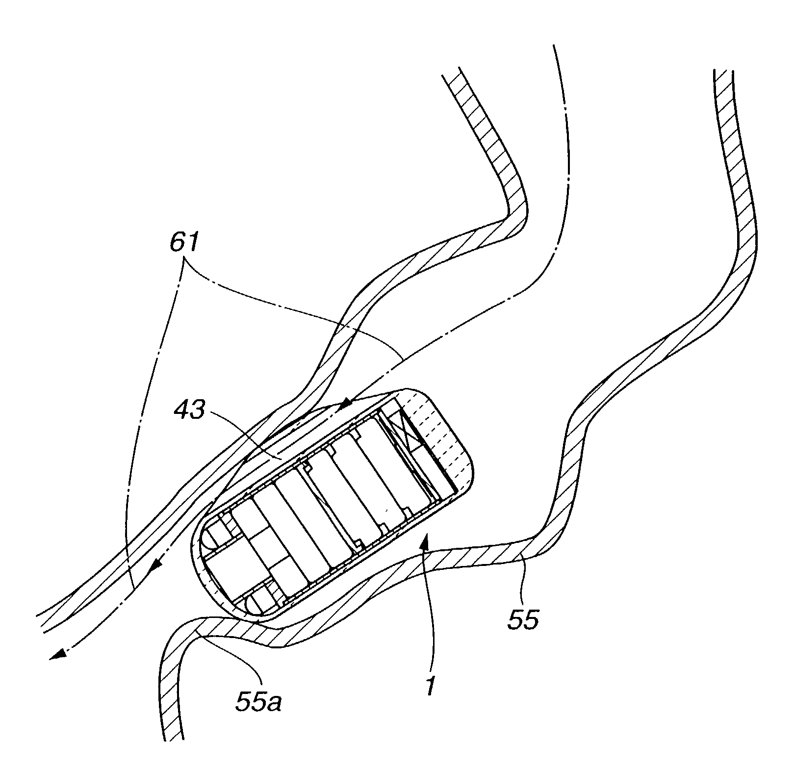 Encapsulated medical device and method of examining, curing, and treating internal region of body cavity using encapsulated medical device