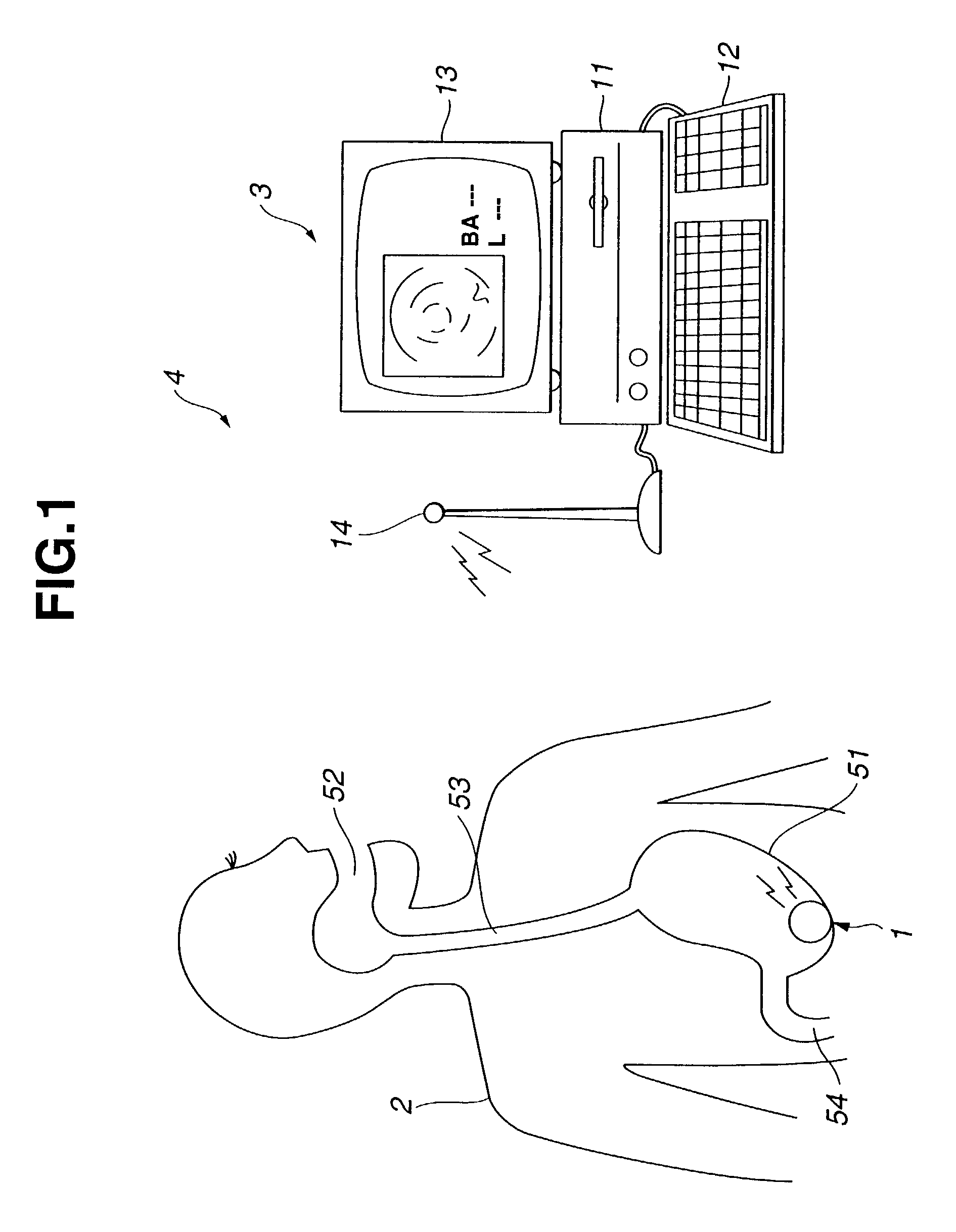 Encapsulated medical device and method of examining, curing, and treating internal region of body cavity using encapsulated medical device