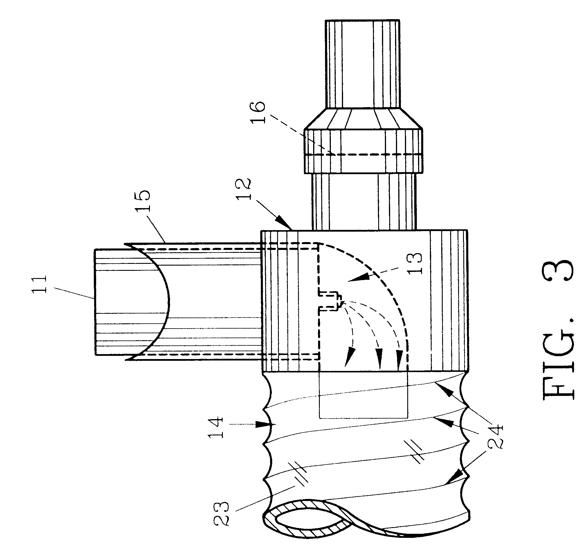 Inhalation therapy assembly and method