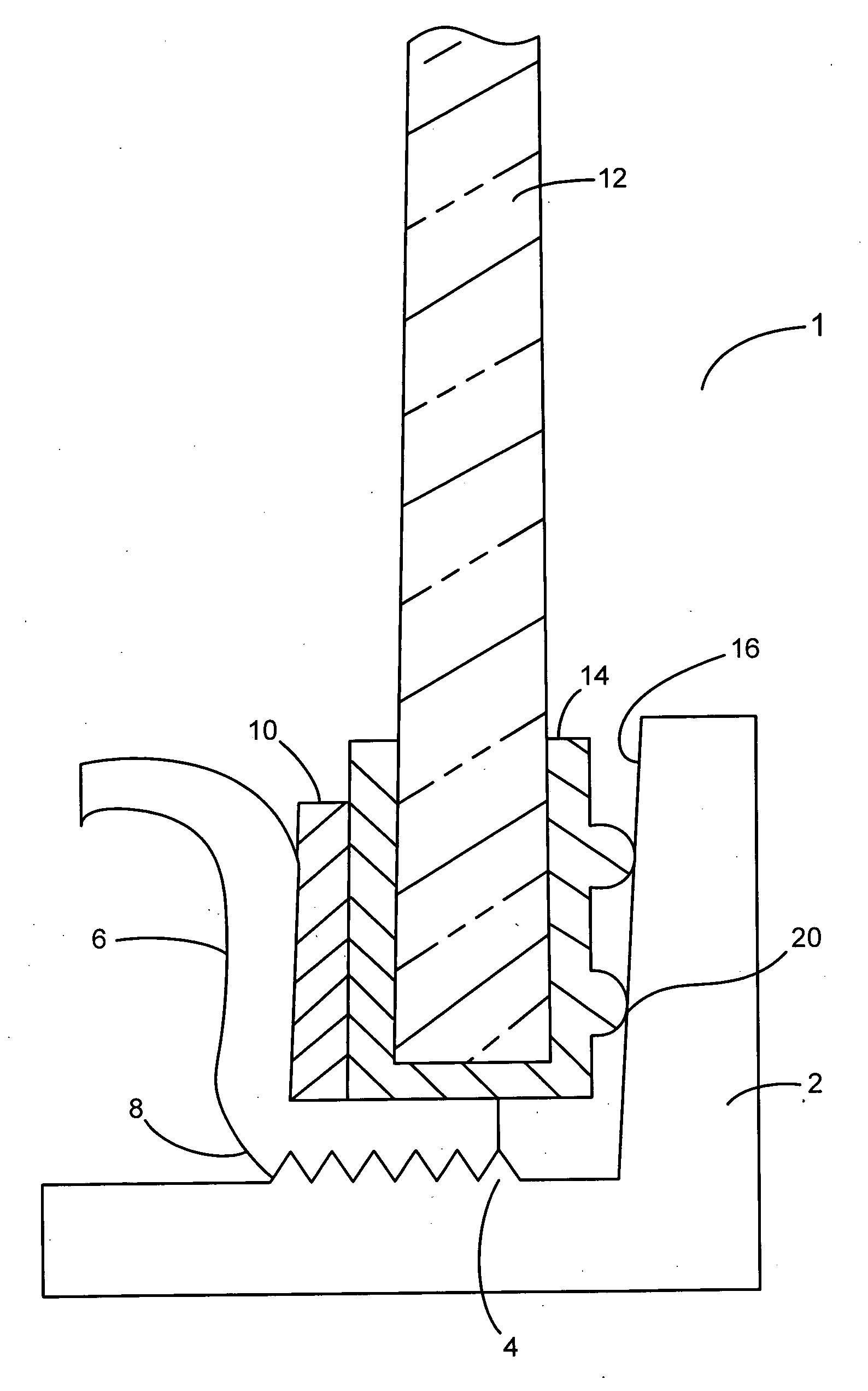 Light fixture lens retaining device and method