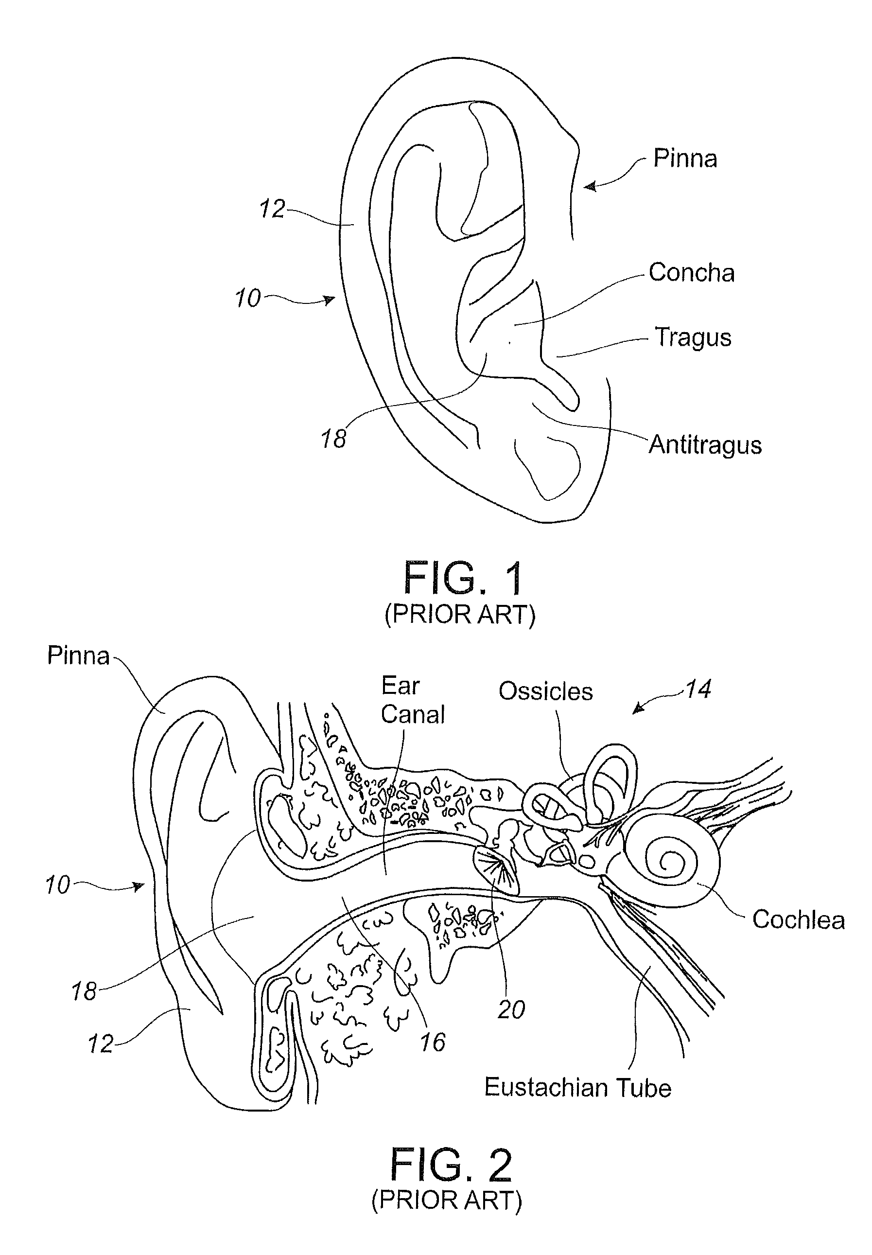 Canal phones with structure and method for selectively passing or blocking environmental ambient sound and switchable electrical connections