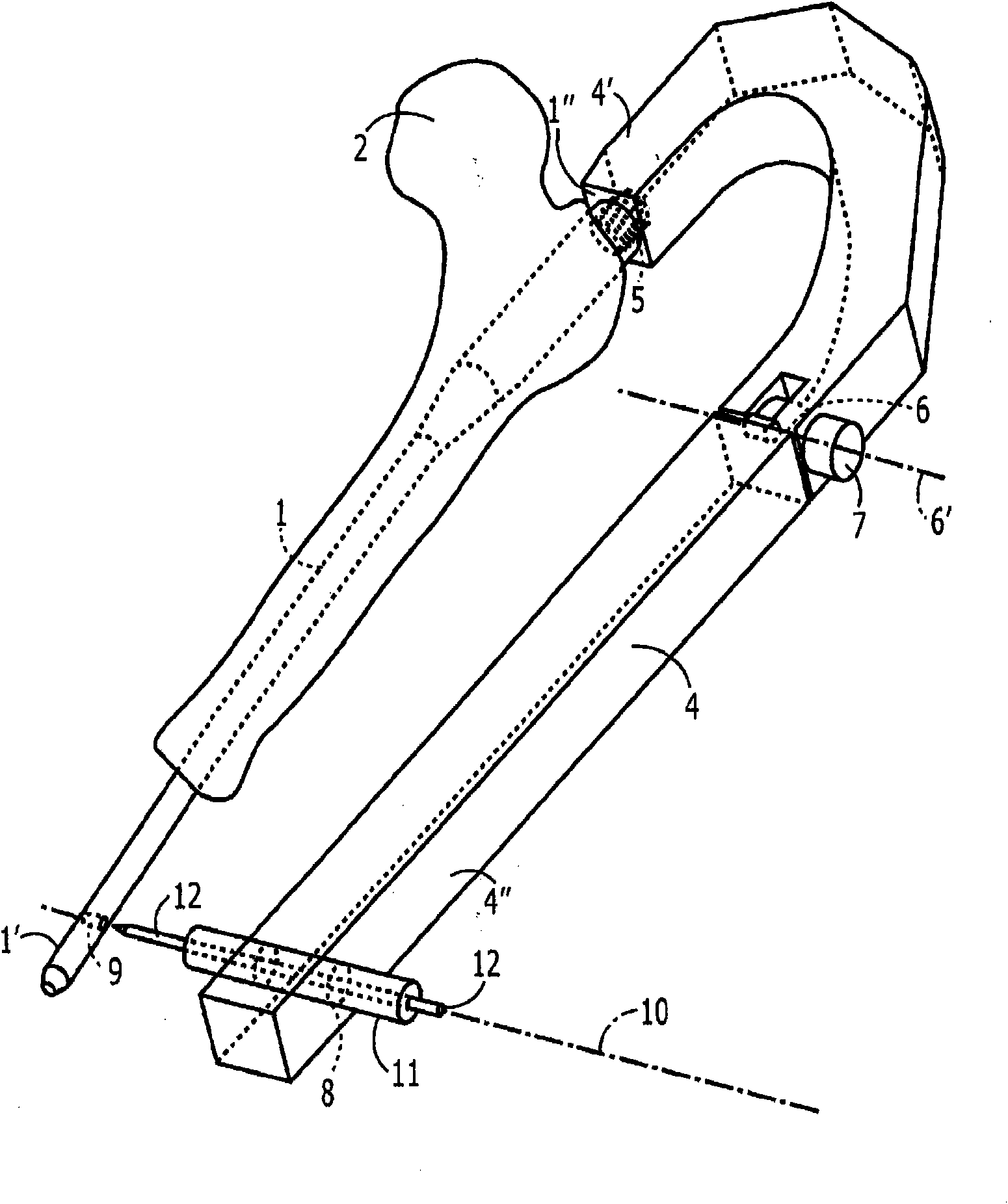 Aiming arm for locking of bone nails