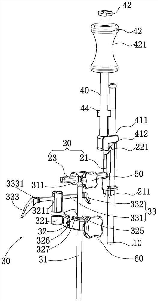 A tibial osteotomy guide