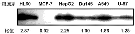 Caspase-3 proenzyme protein immunohistochemical diagnosis kit and application