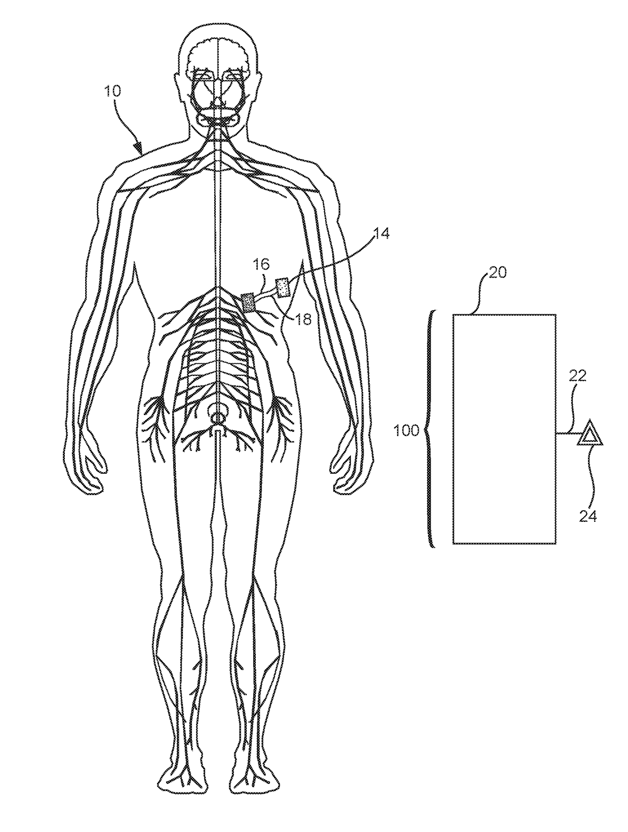 Methods and Compositions for Treating a Condition in a Subject