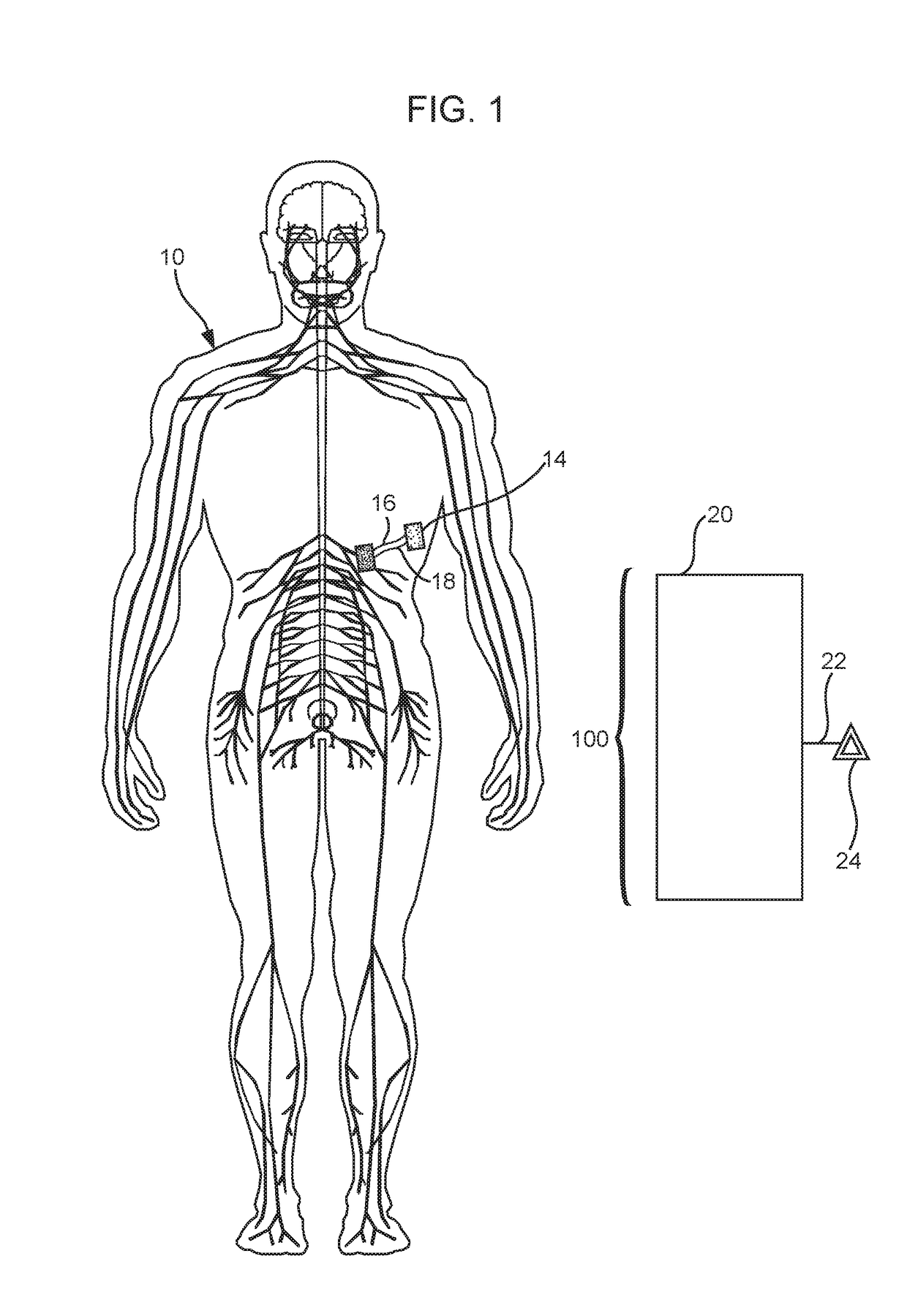 Methods and Compositions for Treating a Condition in a Subject