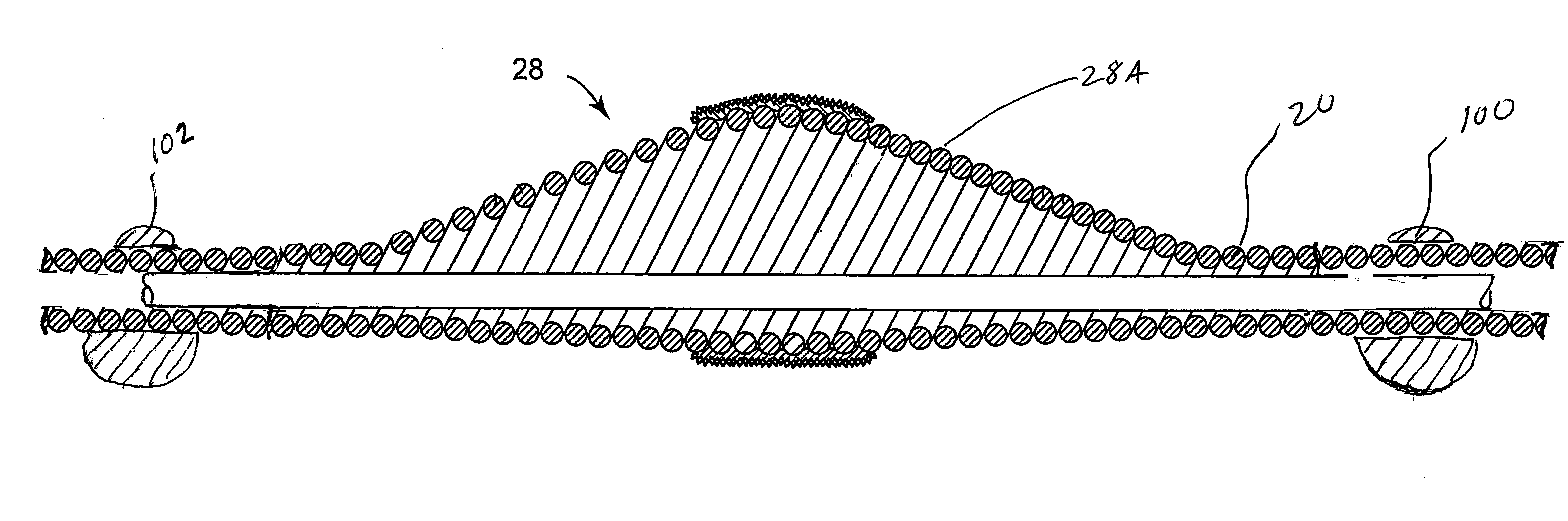 Rotational atherectomy device with counterweighting