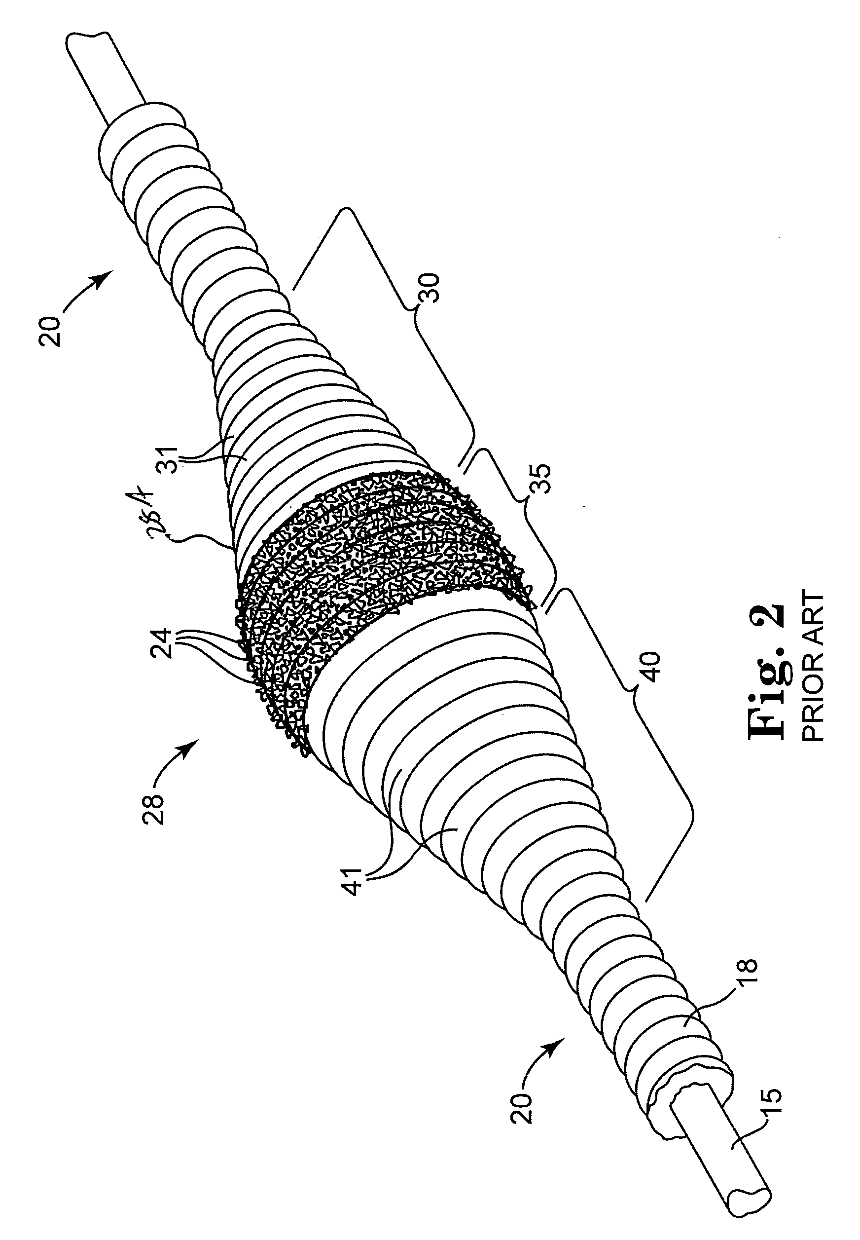 Rotational atherectomy device with counterweighting