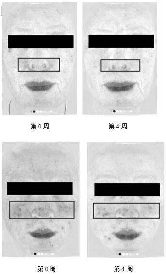 Plant composition as well as preparation method and application thereof