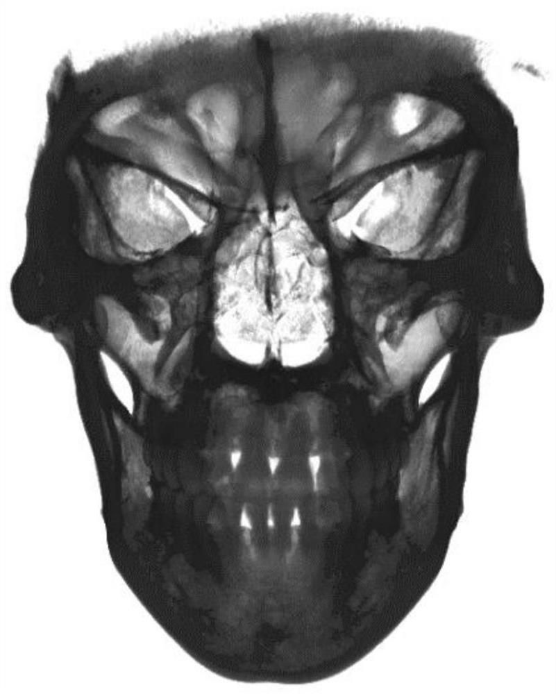 Automatic complete tooth reconstruction method based on multi-modal data registration