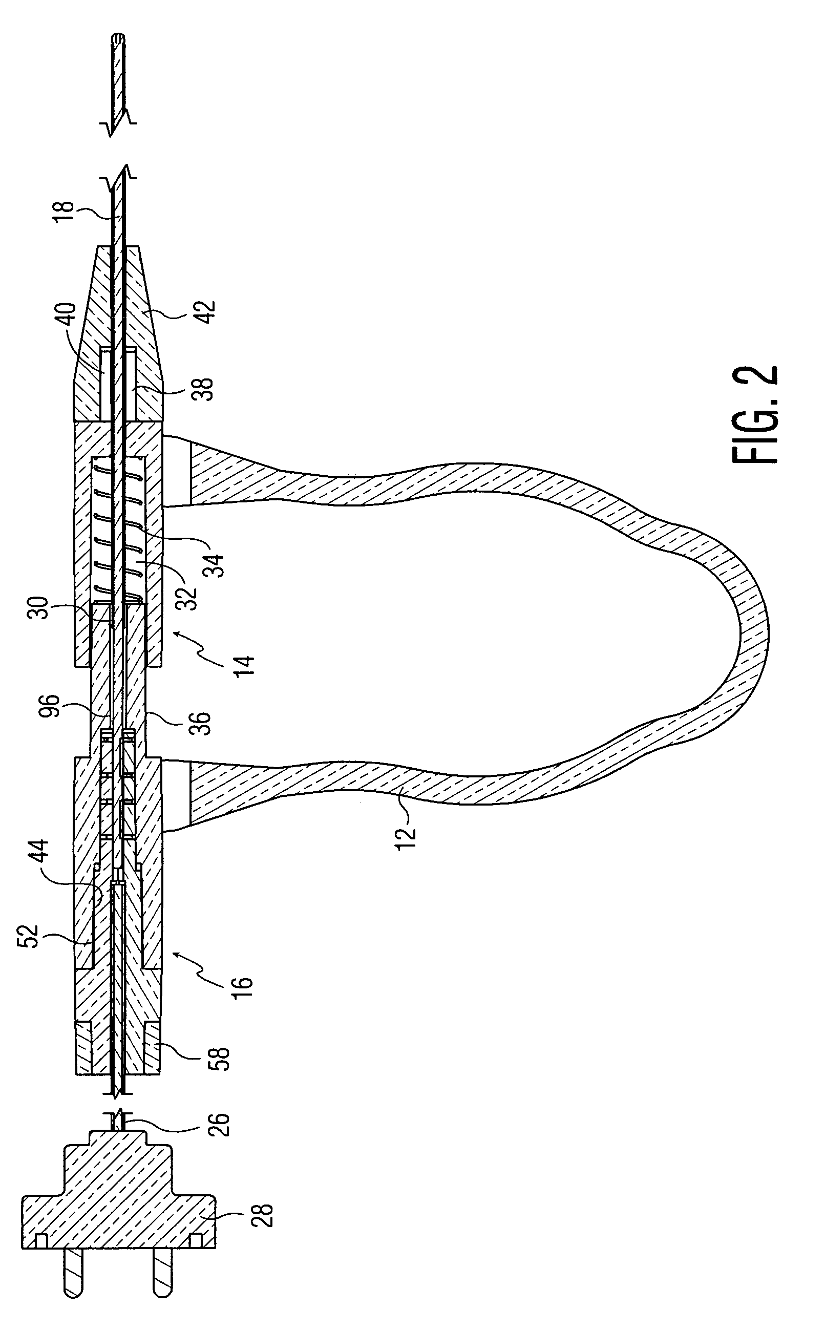 Disposable electrosurgical handpiece for treating tissue