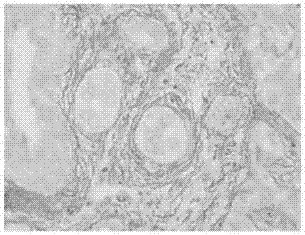 Dyeing method for observing collagenous fibers by adopting polarization microscope