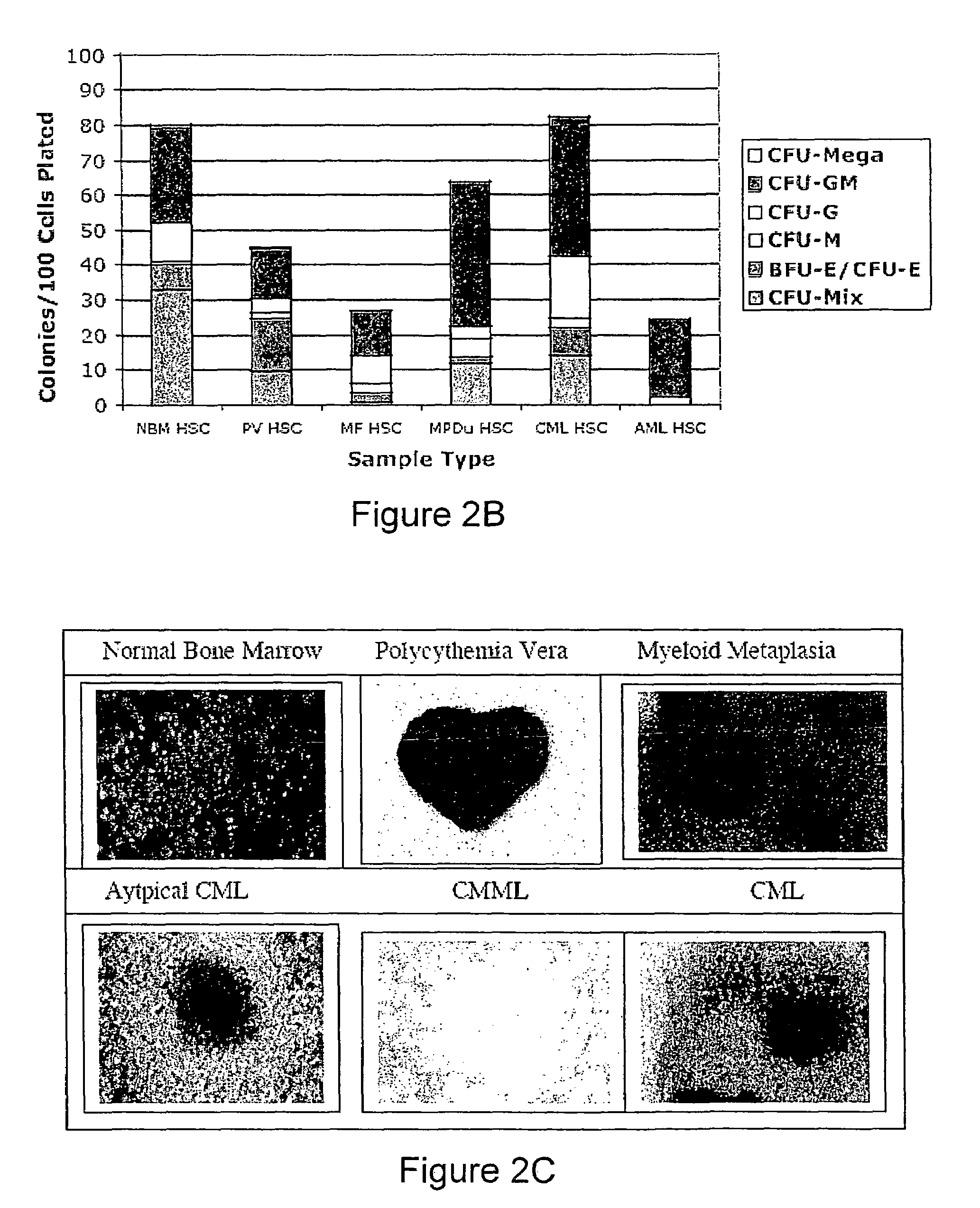 Methods for diagnosing and evaluating treatment of blood disorders