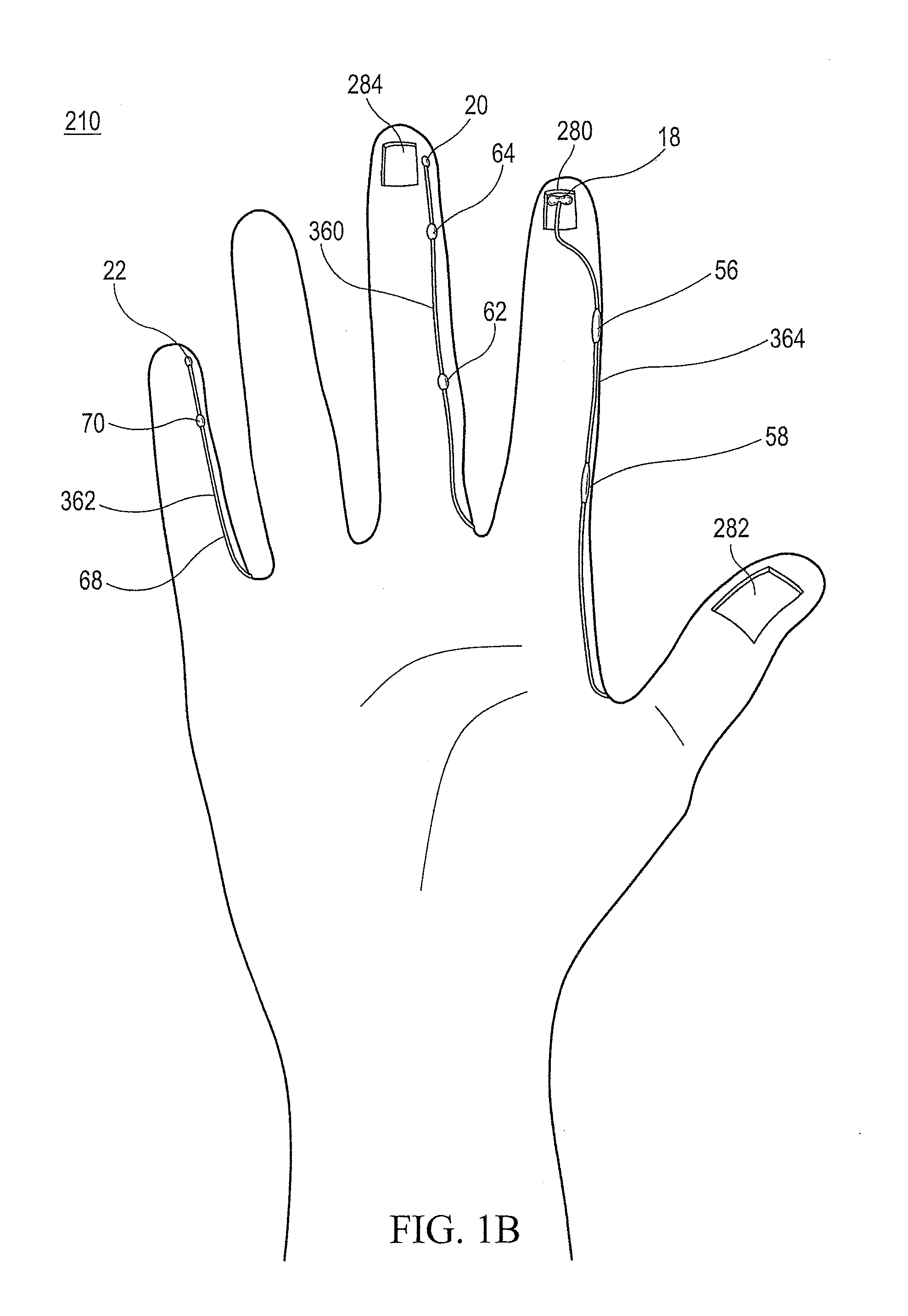 Method of making polymeric gloves having embedded surgical support systems and discrete elements