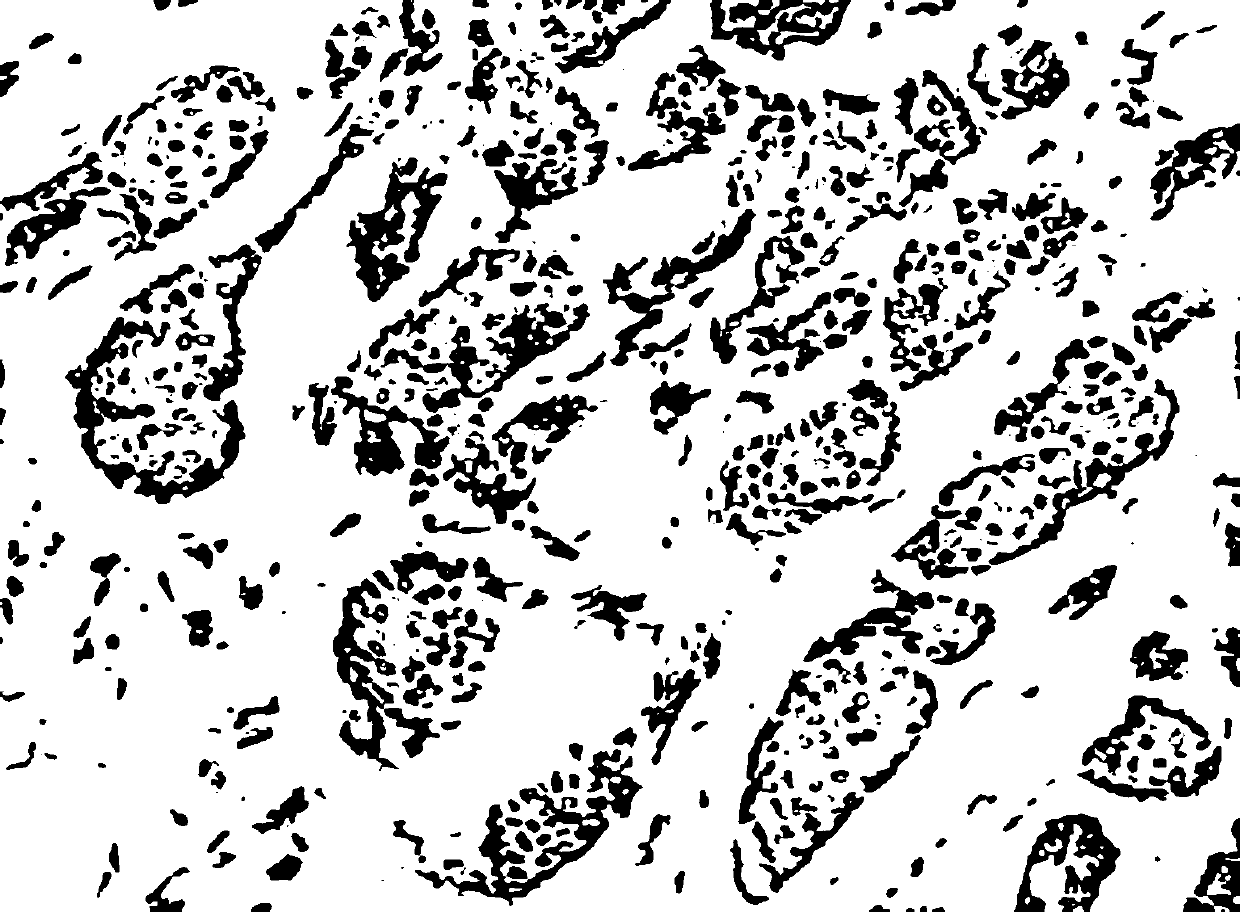A breast cancer Ki67/ER/PR nuclear staining cell counting method based on staining separation