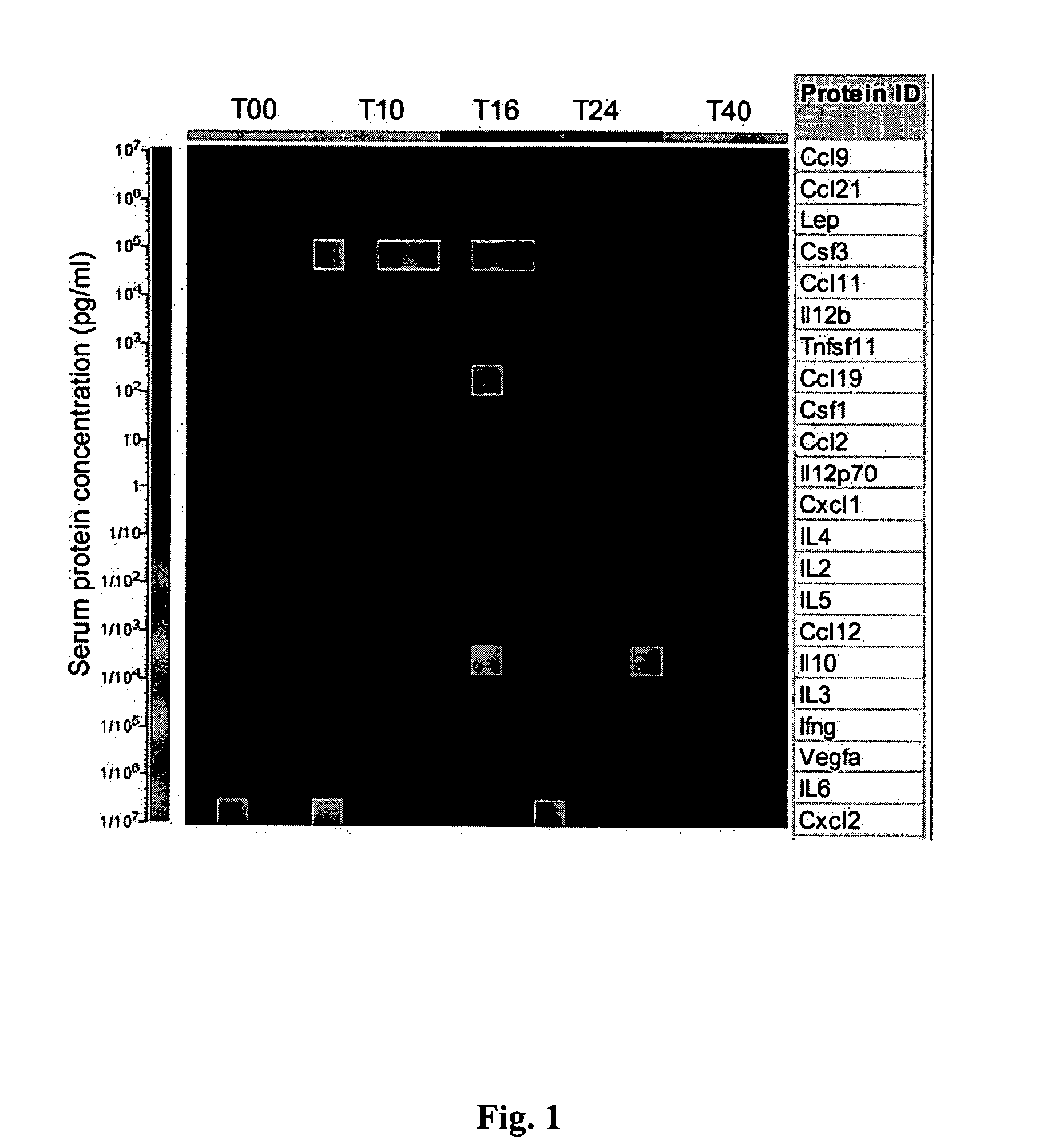 Methods and compositions for diagnosis and monitoring of atherosclerotic cardiovascular disease