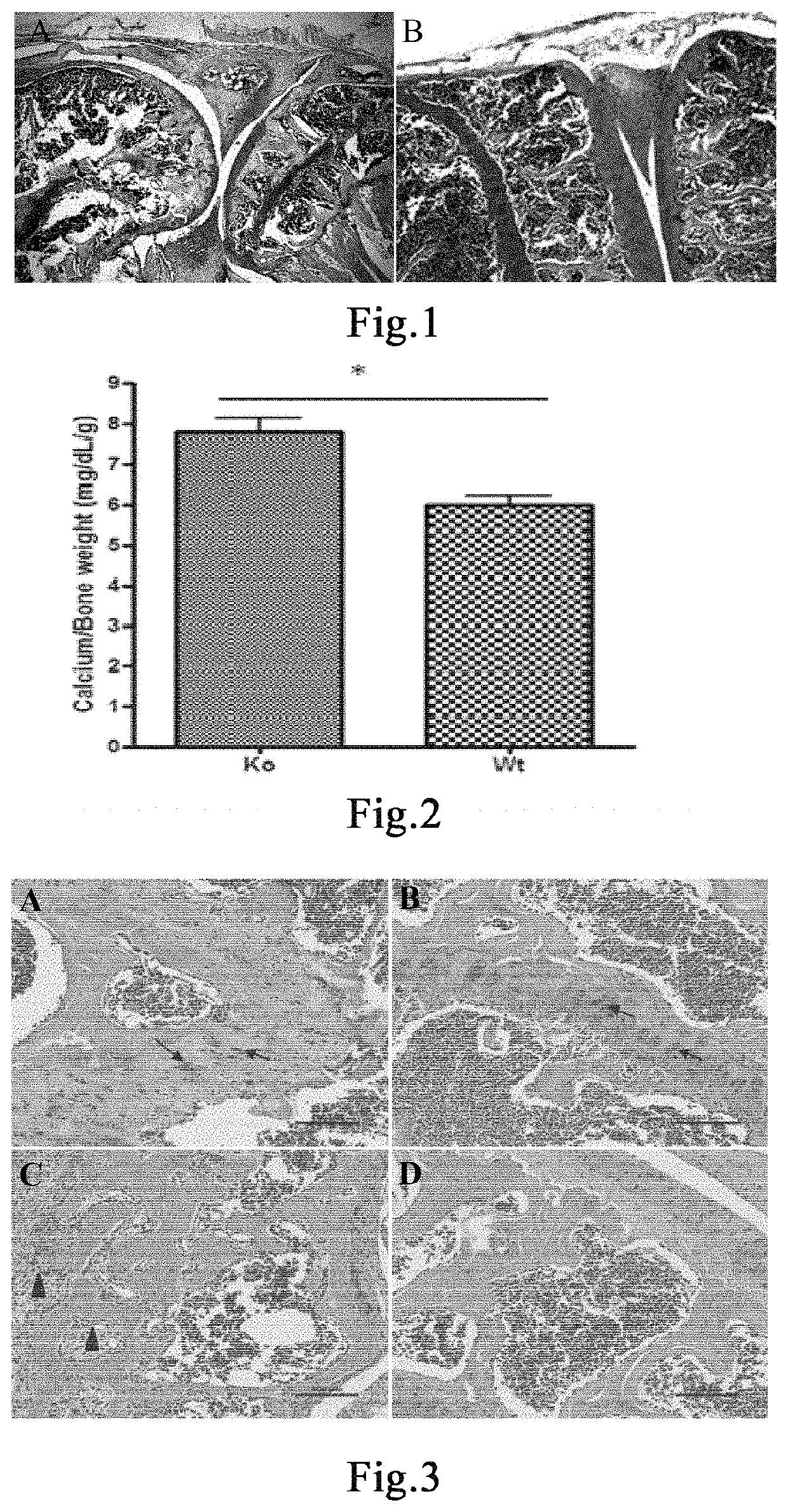 Drug for preventing and treating osteoporosis and uses thereof