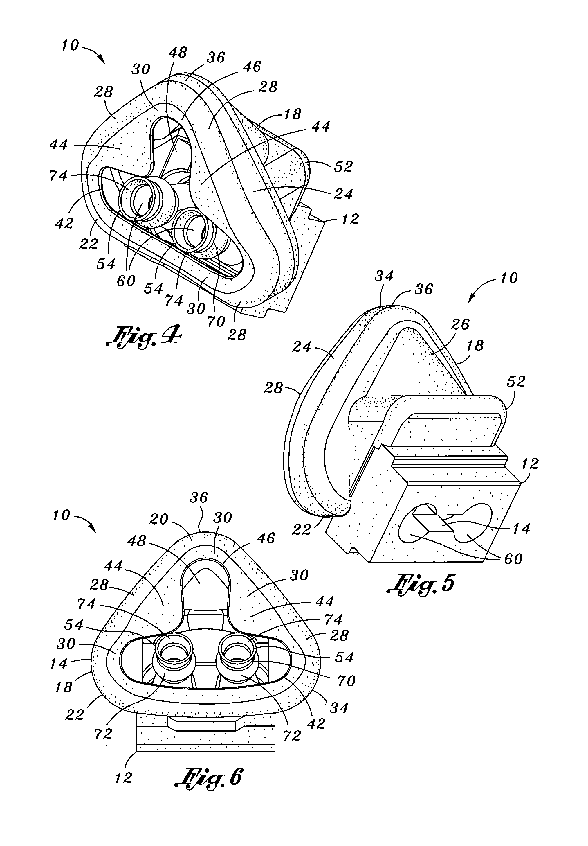 Integrated mask and prongs for nasal CPAP