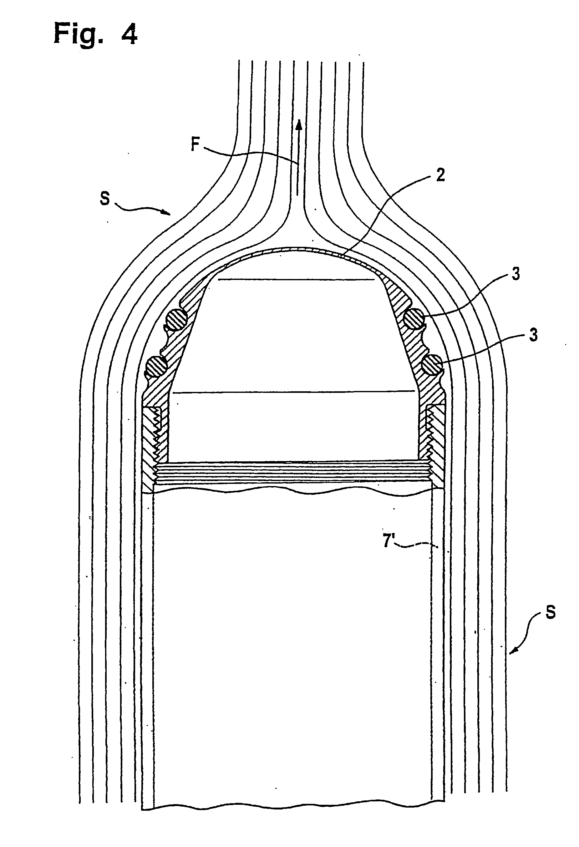 Impact part of a projectile