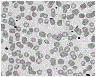 Rapid and sensitive detection method for plasmodium vivax