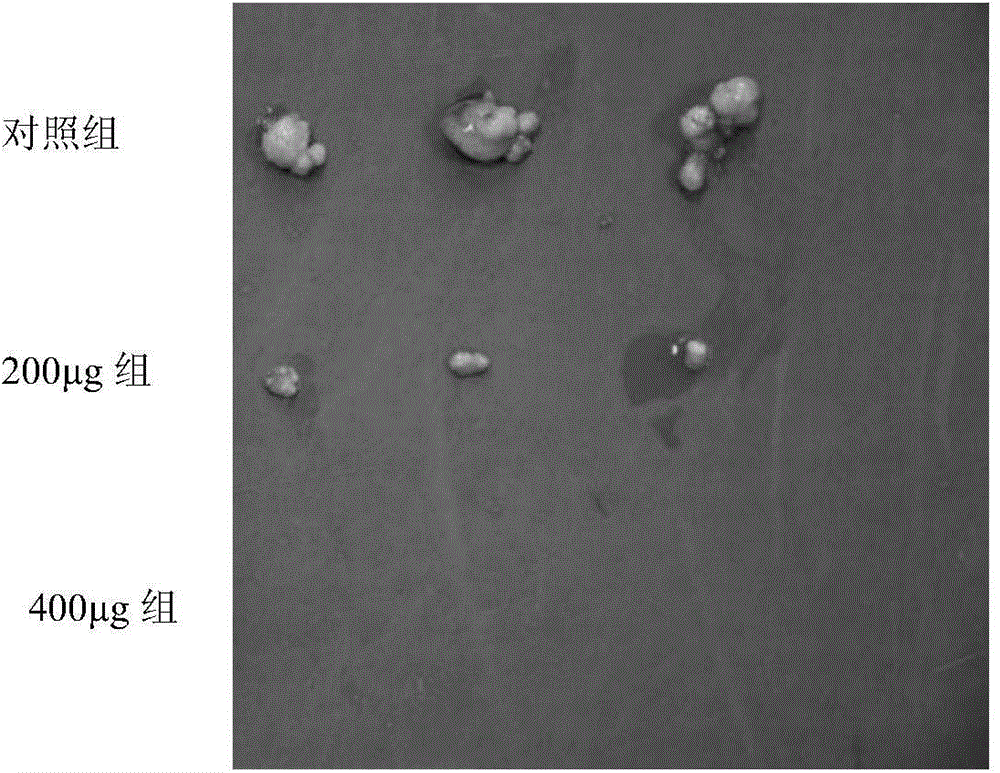 New application of pyrimethamine and medicinal composition for treating for tumor