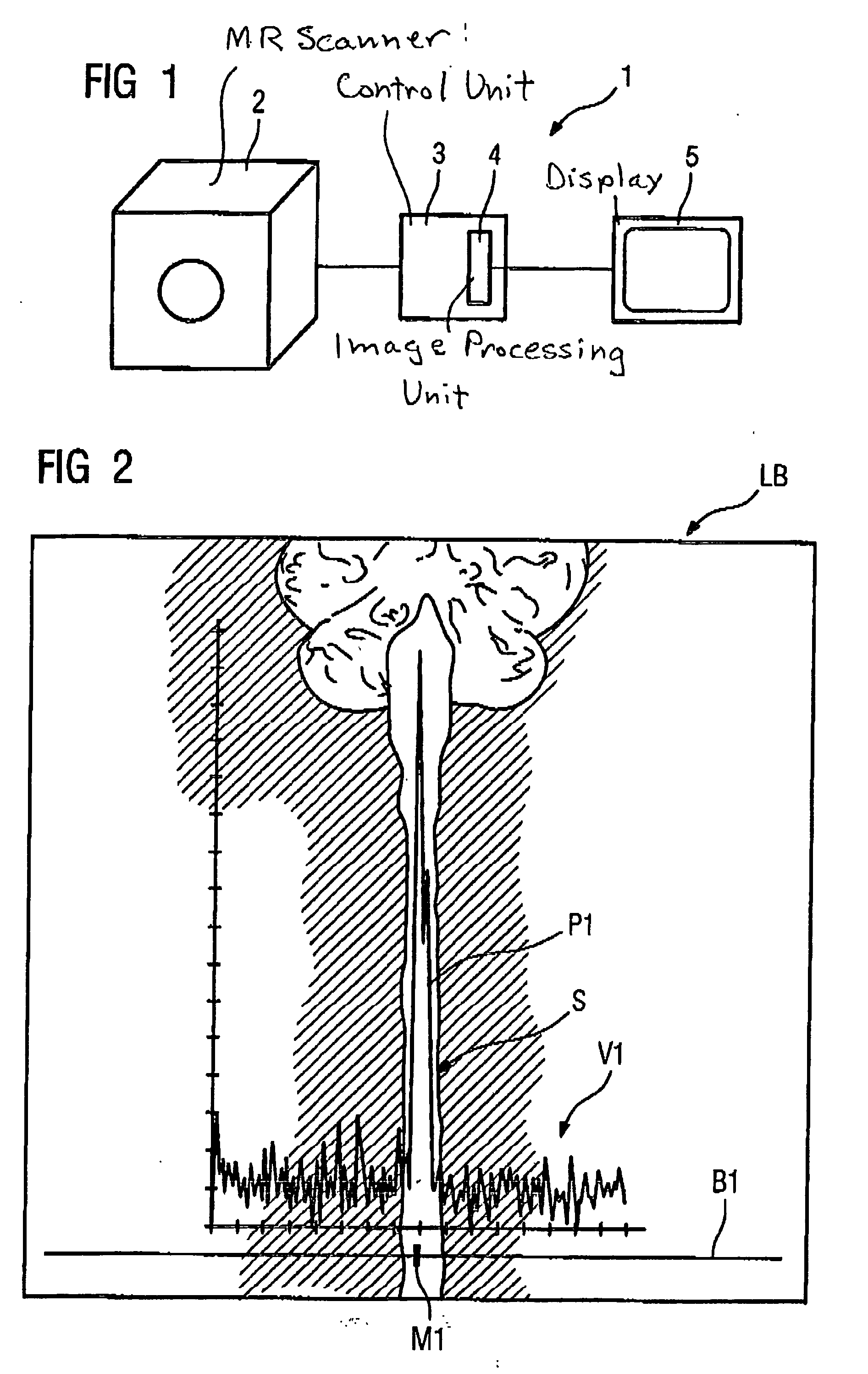 Method and magnetic resonance imaging apparatus for automatically determining the sagittal plane of a subject