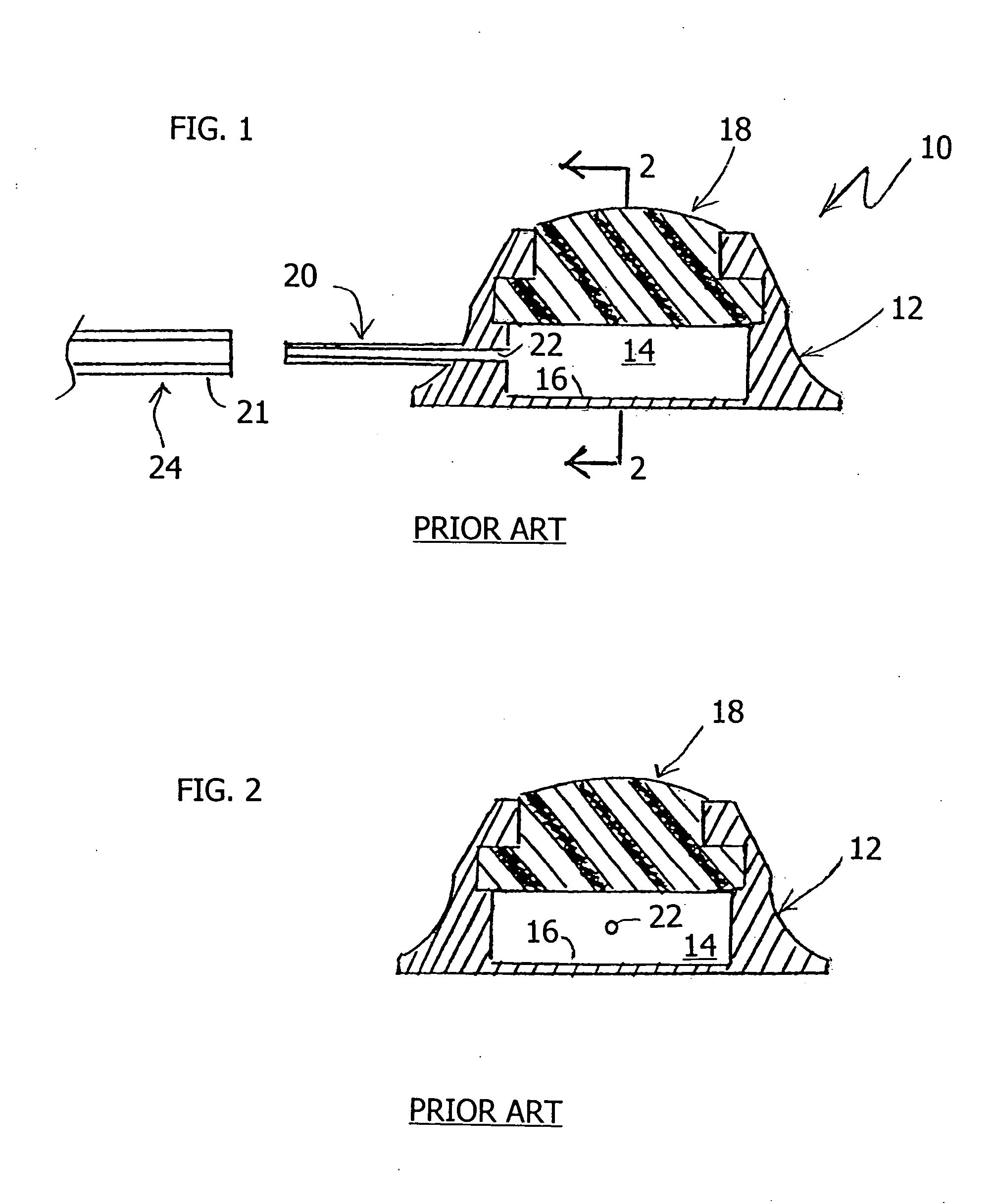 Subcutaneous vascular access port, and method of using same