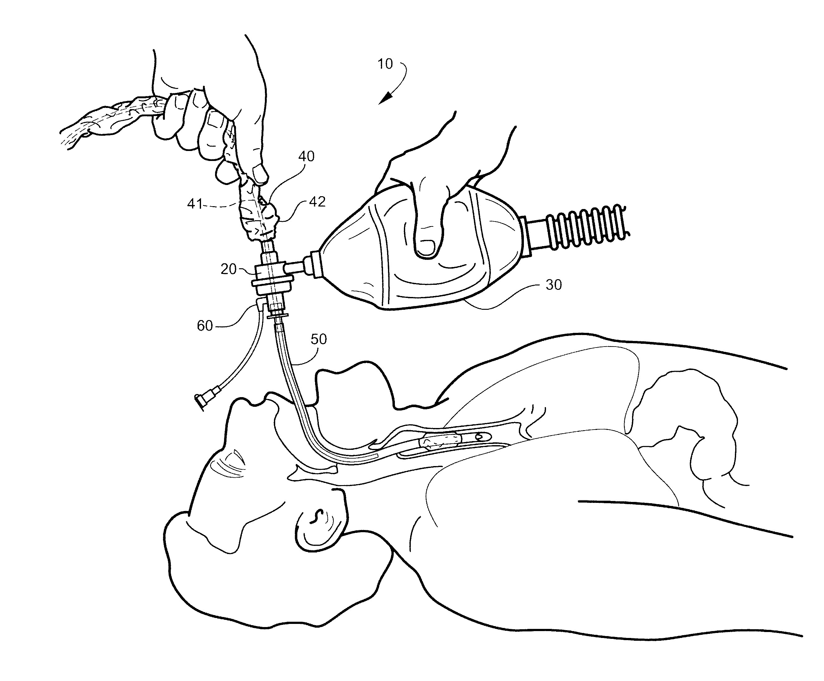 Device having manual resuscitation and suction capabilities