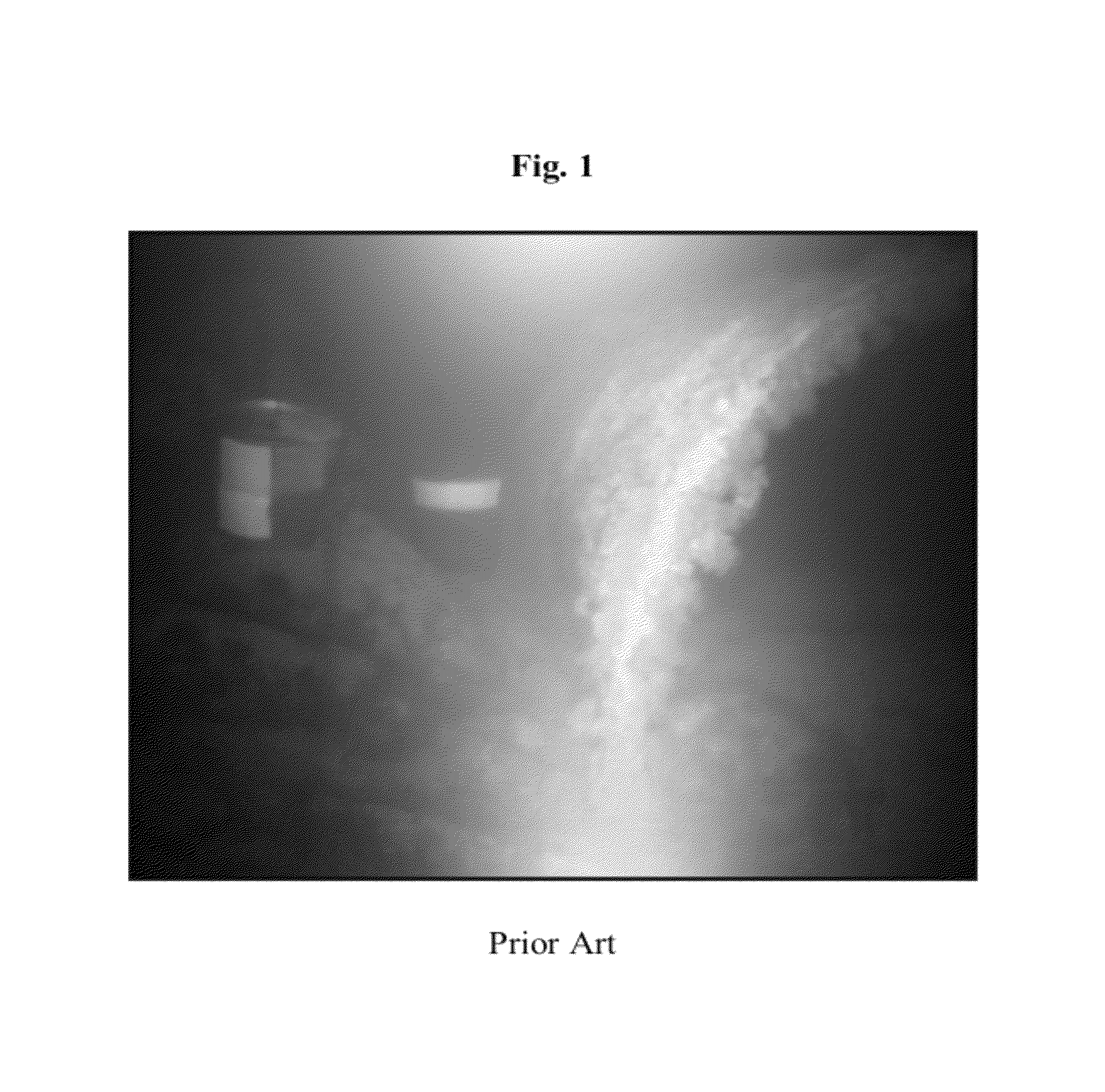 Imaging systems and methods for recovering object visibility