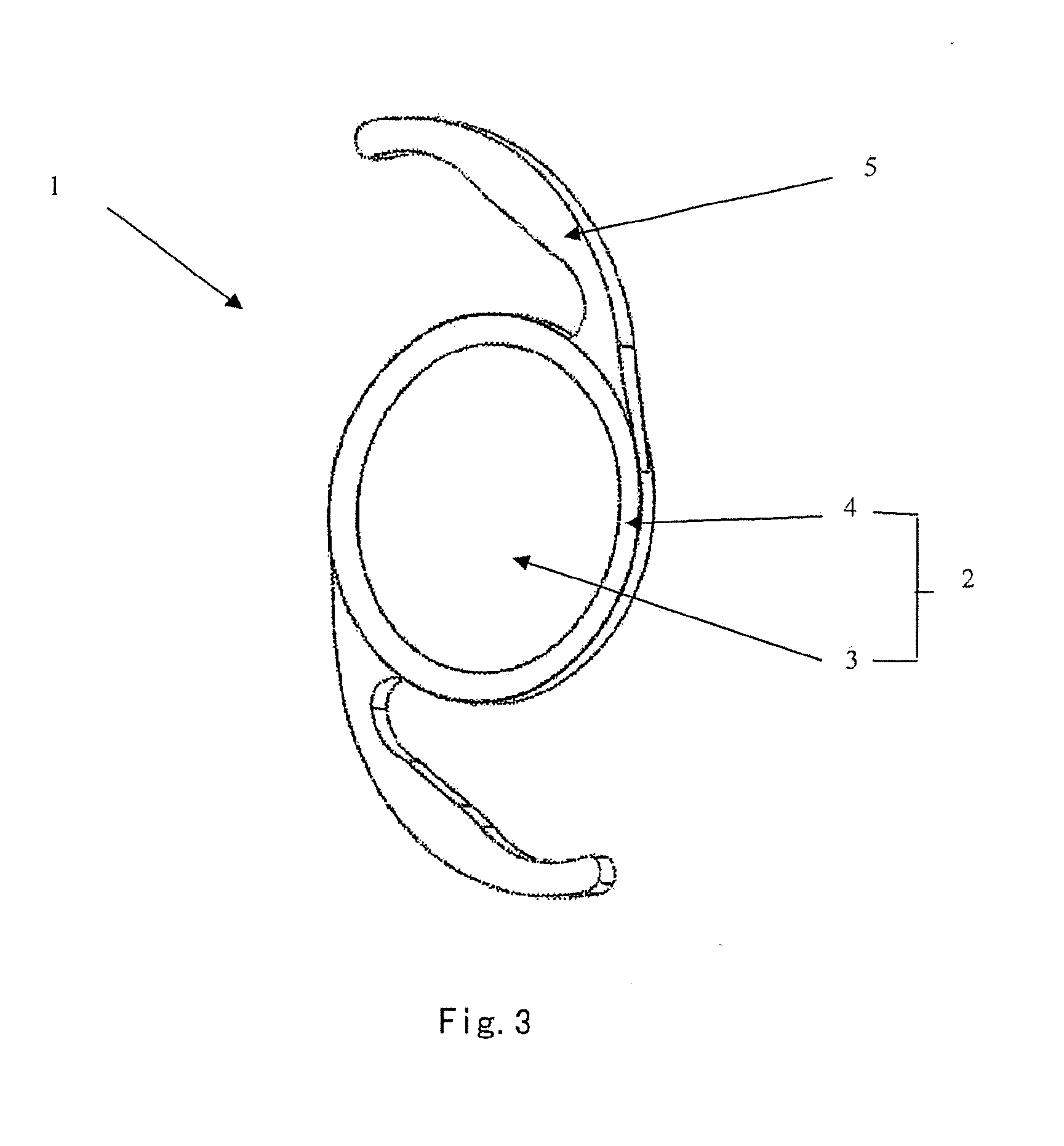 Posterior chamber intraocular lens
