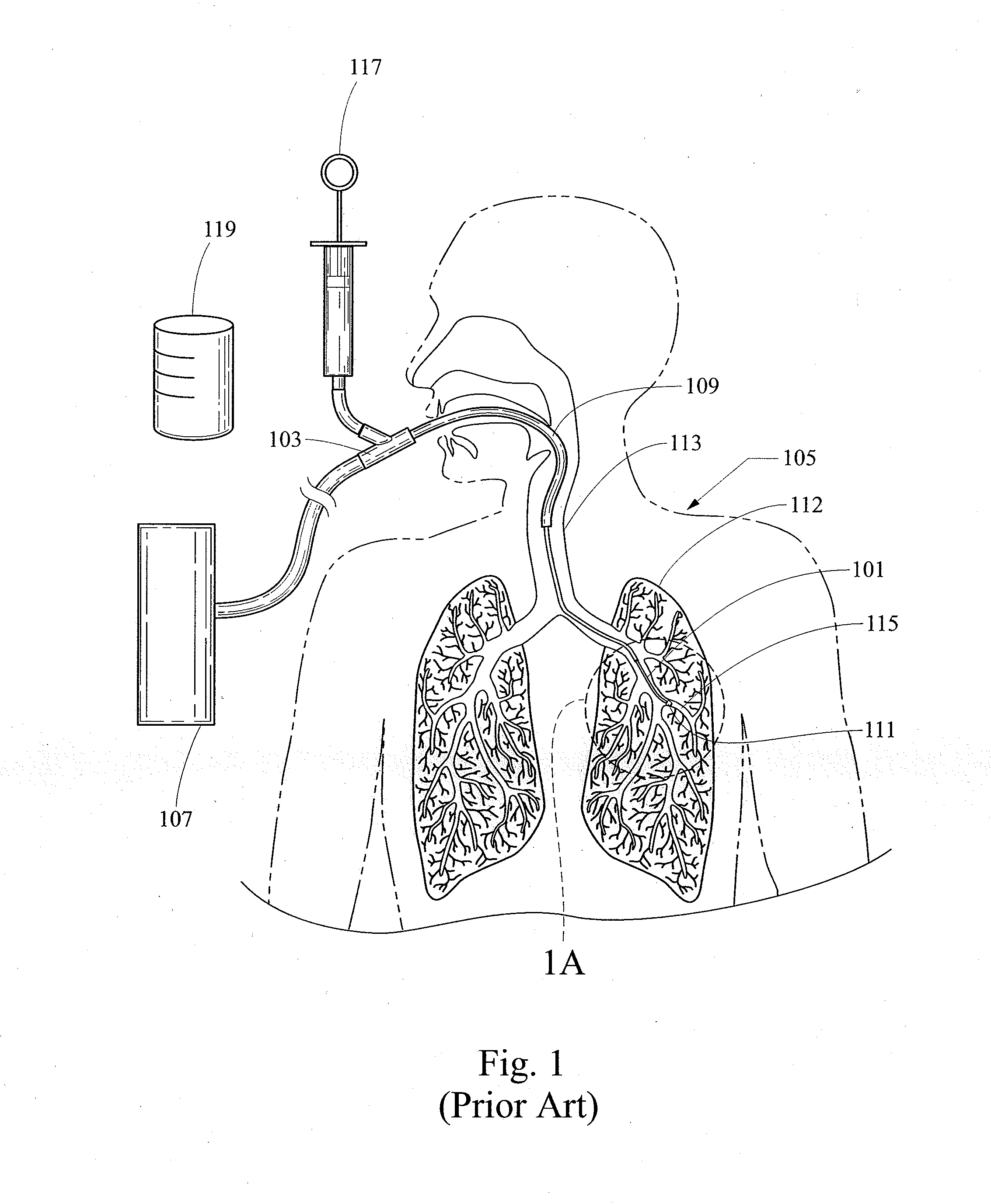 Diagnostic sample collection system and method of use