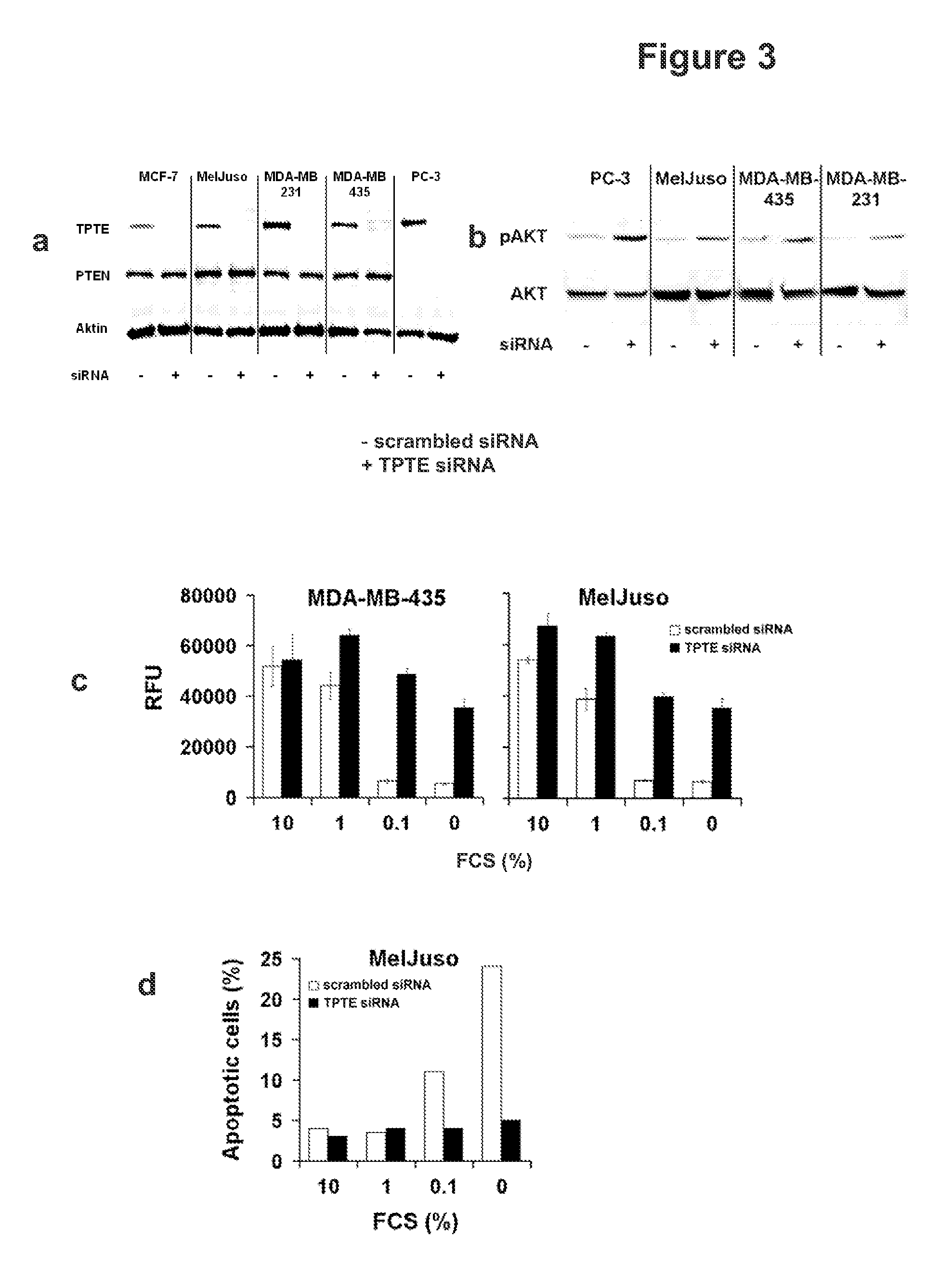 Compositions and methods for therapy and diagnosis of cancer and cancer metastasis