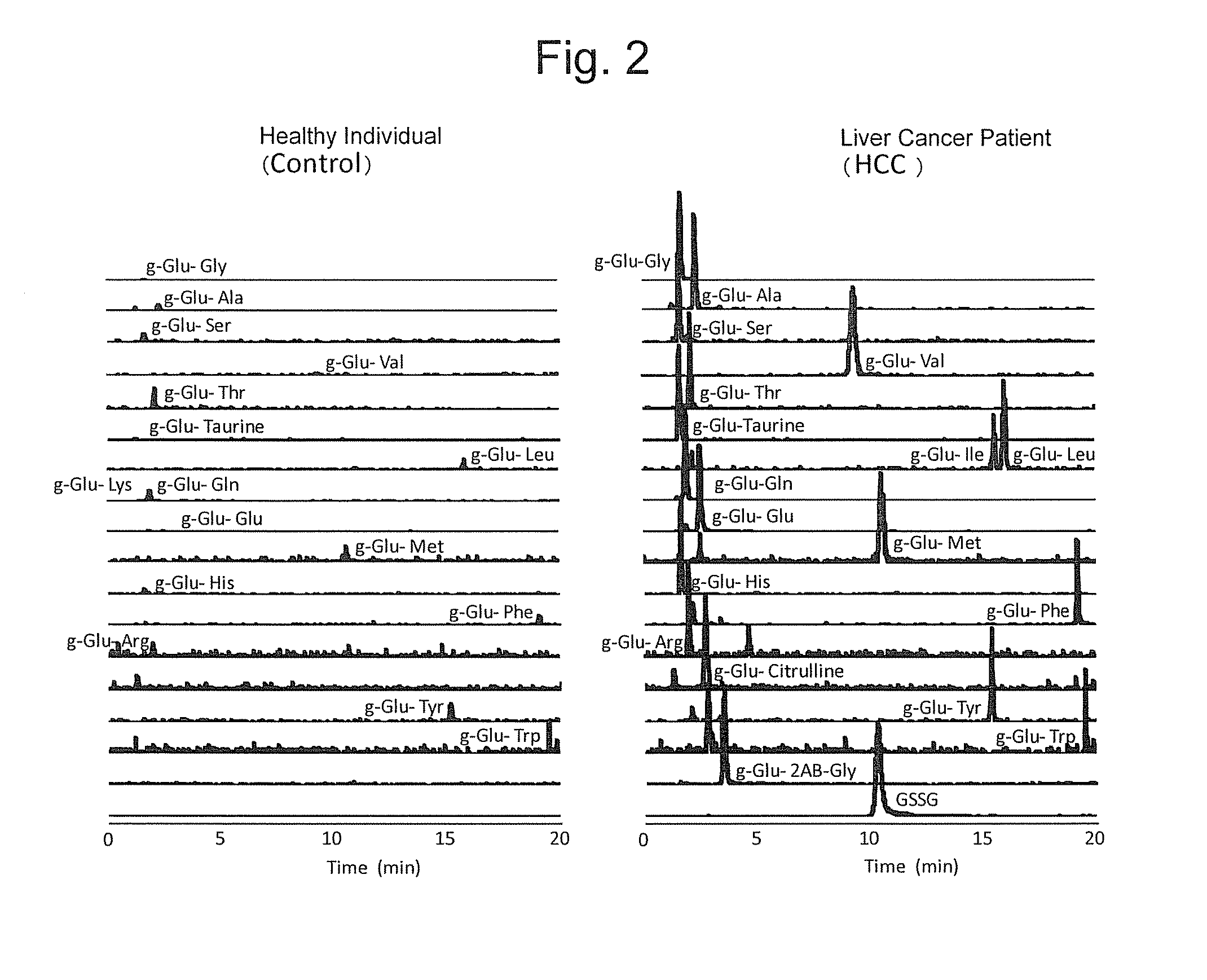 Liver disease marker, method and apparatus for measuring the same, and method for assaying pharmaceutical preparation