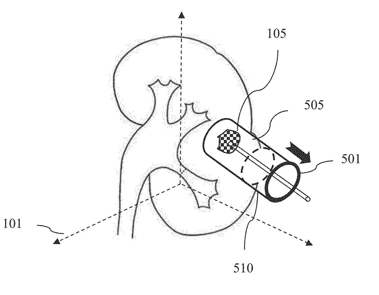 Method and system for interactive grid placement and measurements for lesion removal