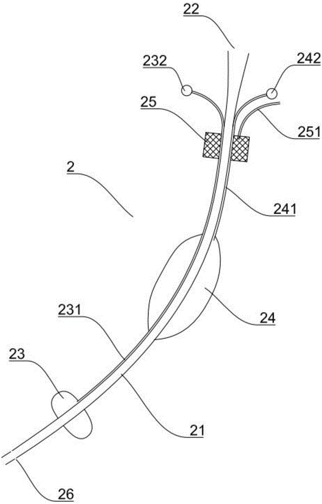 Medical esophageal catheter and preparation method thereof, and ventilating device
