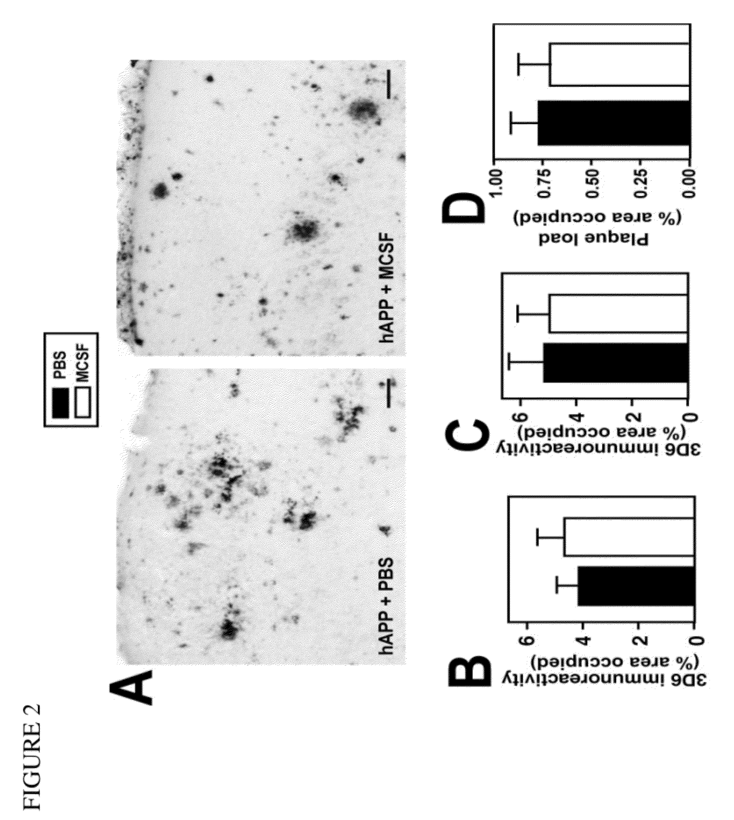 Methods of neuroprotection involving macrophage colony stimulating factor receptor agonists