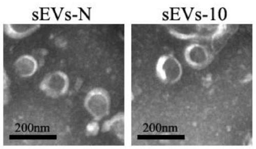 Application of mesenchymal stem cell-derived small extracellular vesicles overexpressing interleukin 10 in preparation of drugs for treating autoimmune diseases