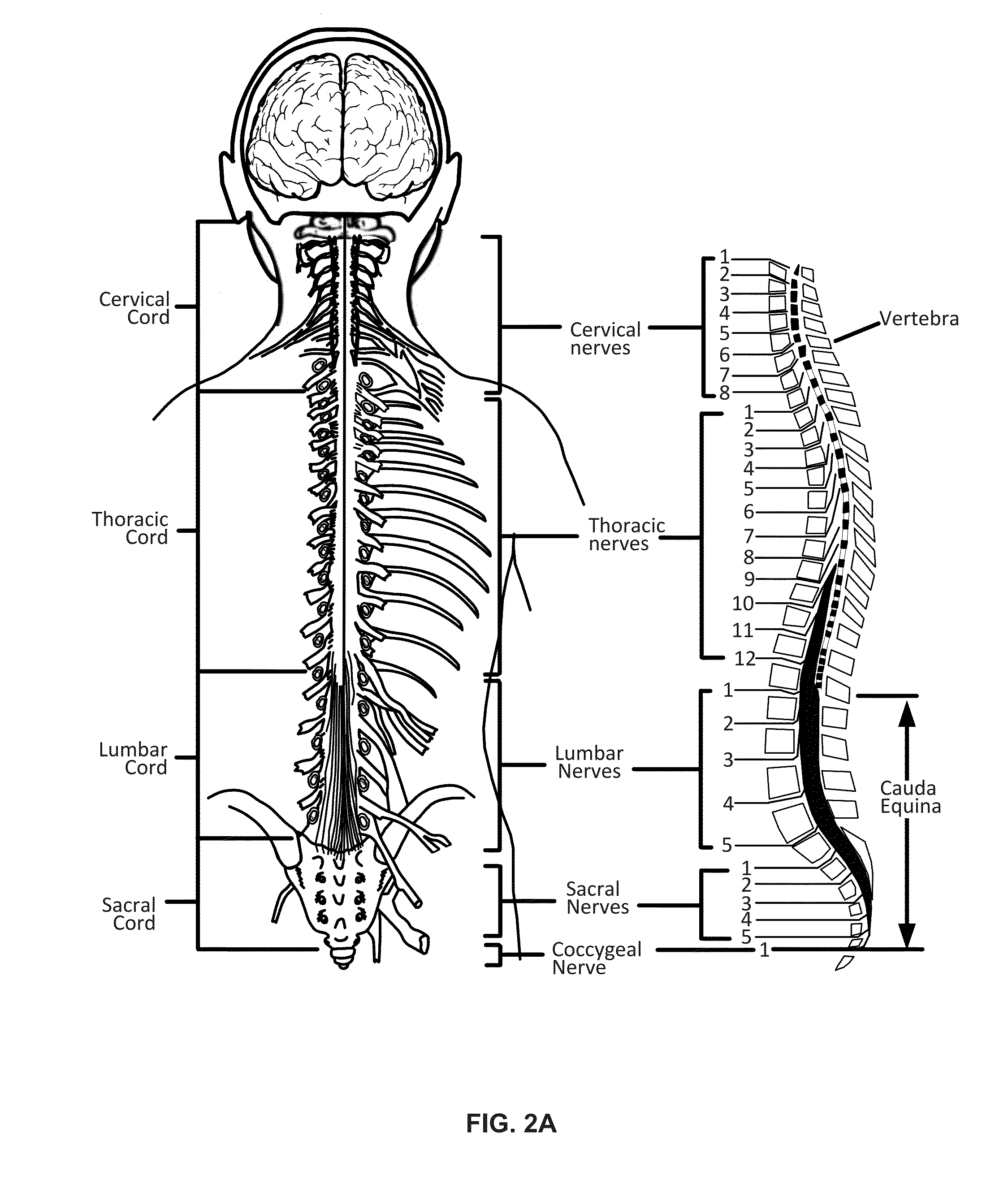 Patient remote and associated methods of use with a nerve stimulation system