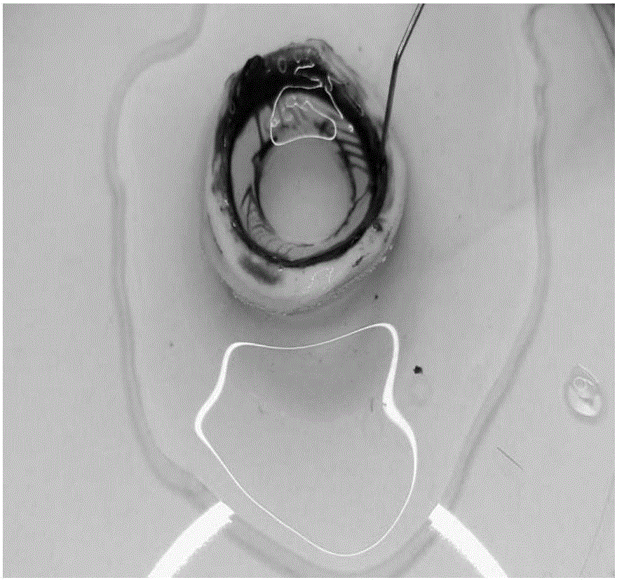 Graft for descemet membrane endothelial keratoplasty and vacuole separation preparation method of graft