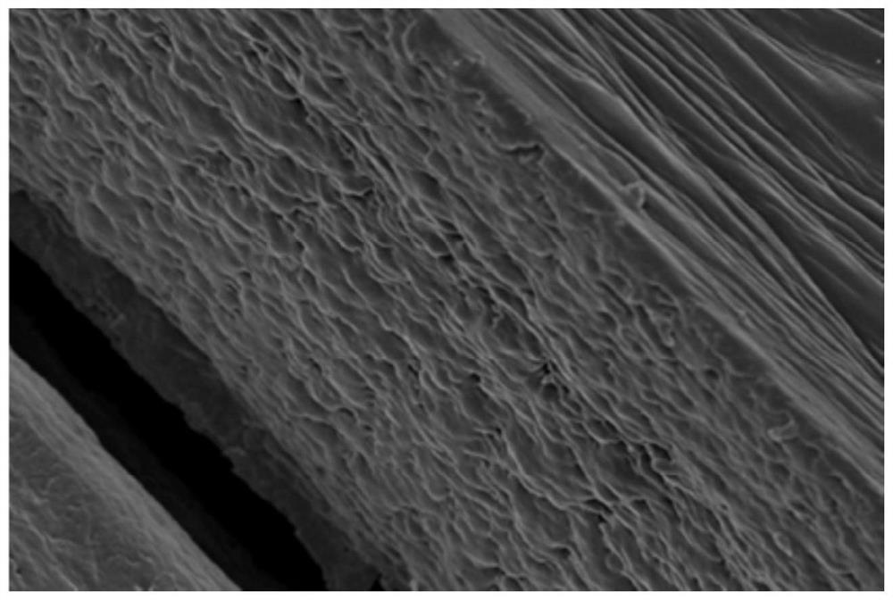 A kind of preparation method of antifungal corneal repair material