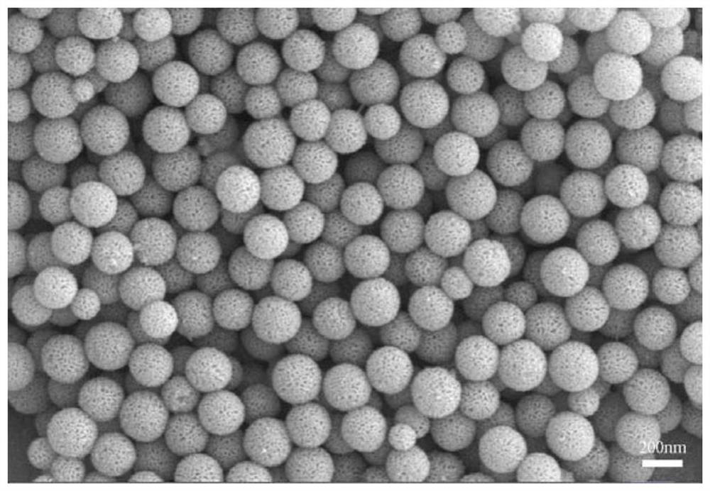 Mesoporous bioactive glass/chitosan composite hemostatic sponge and preparation method thereof