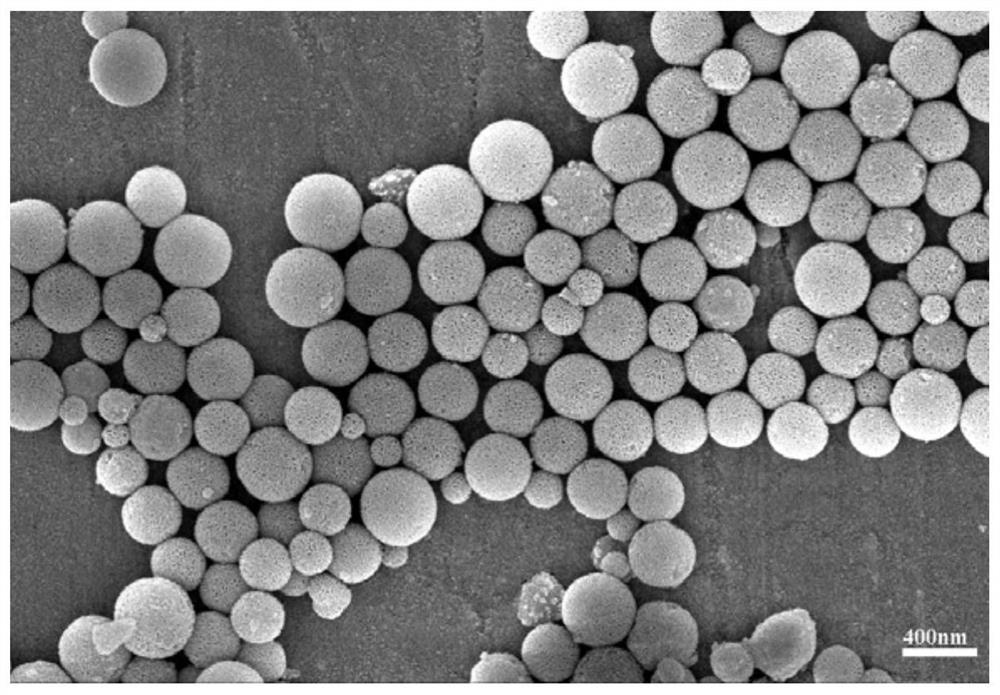 Mesoporous bioactive glass/chitosan composite hemostatic sponge and preparation method thereof